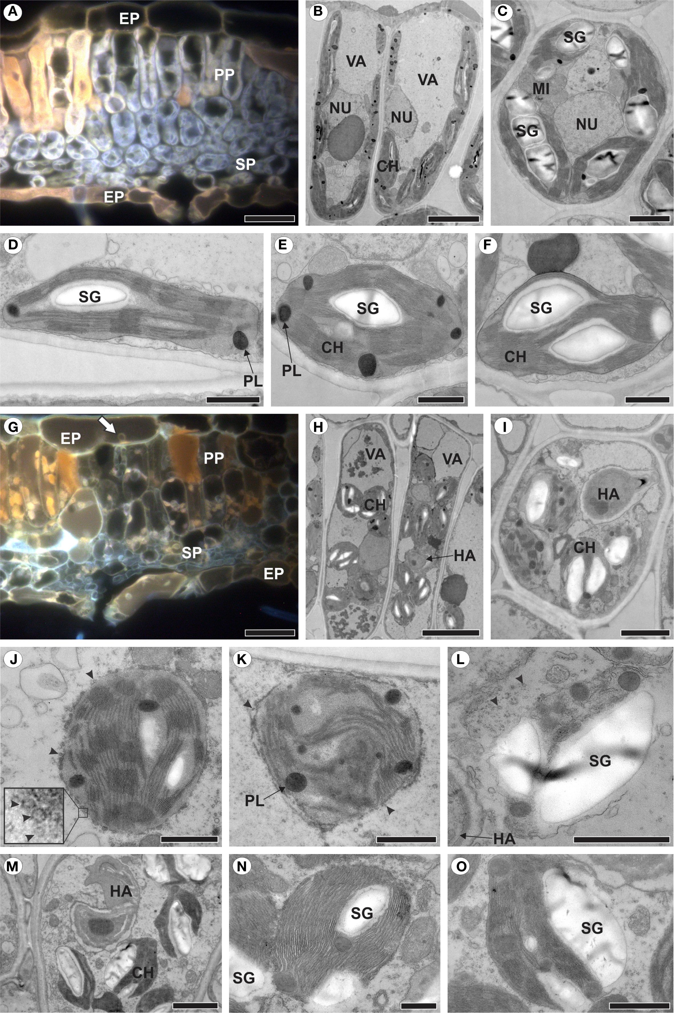 Microscopic images showing various cell structures and organelles. Panels A and G highlight autofluorescence in healthy and infected leaves, respectively. Panels B, C, H, and I show healthy and infected cells. Panels D to F and J to O focus on chloroplasts. Abbreviations include starch grains (SG), mitochondria (MI), chloroplasts (CH), epidermis (EP), palisade parenchyma (PP), spongy parenchyma (SP), vacuole (VA), and nucleus (NU). Bars indicate scale for each image.