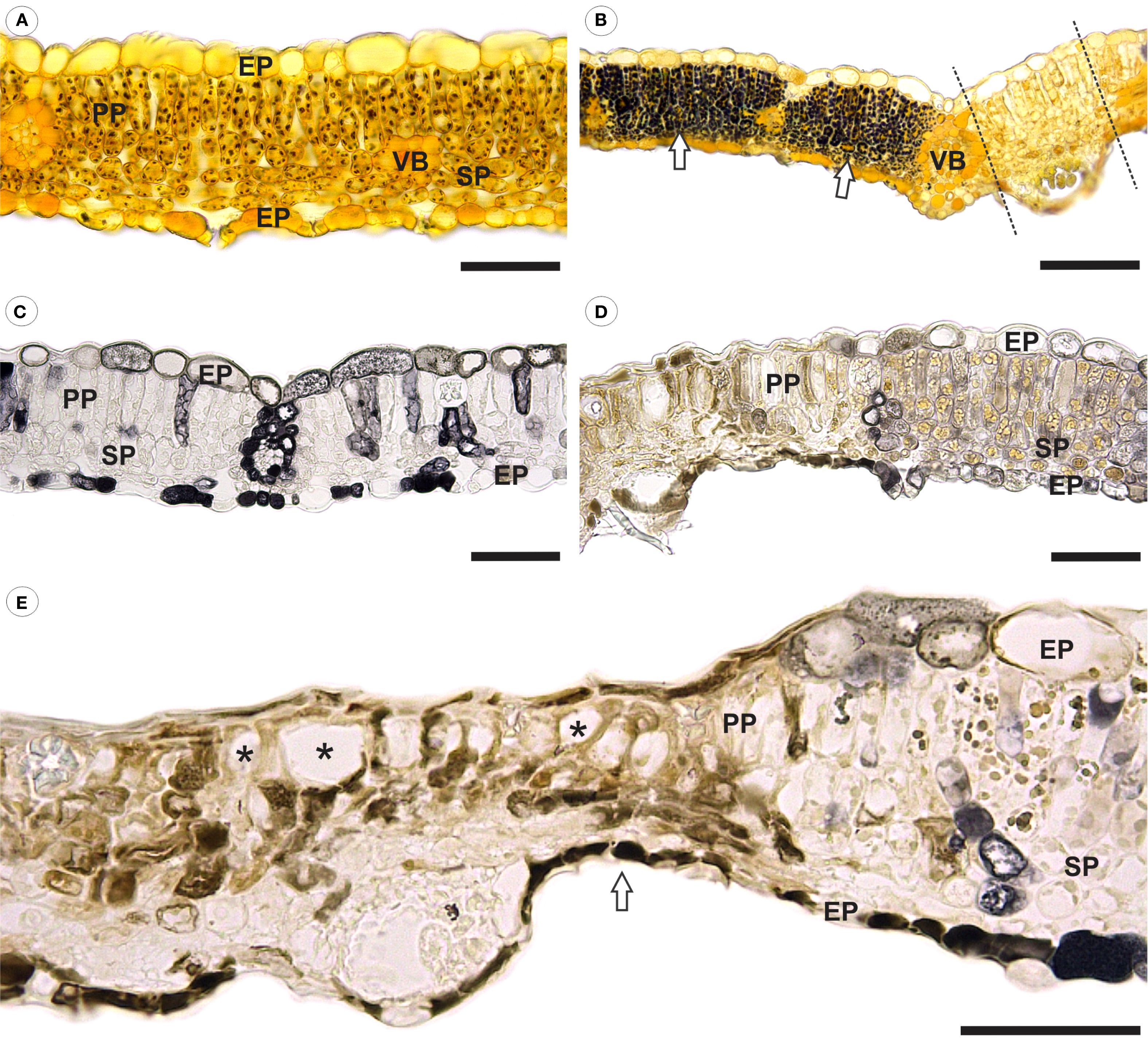 Cross-section images of healthy and fungus-infected raspberry leaves. Panels A and B show healthy and infected leaves 14 days after infection, with dark starch spots near infected sites (arrows). Panel C shows a healthy leaf, while Panels D and E show infected leaves 21 days after infection, with increased phenolic compounds. Panel E displays necrosed and collapsed cells cause thinner leaf tissue (arrow) and large empty spaces (*) inside the leaf. Bars indicate scale for each image.