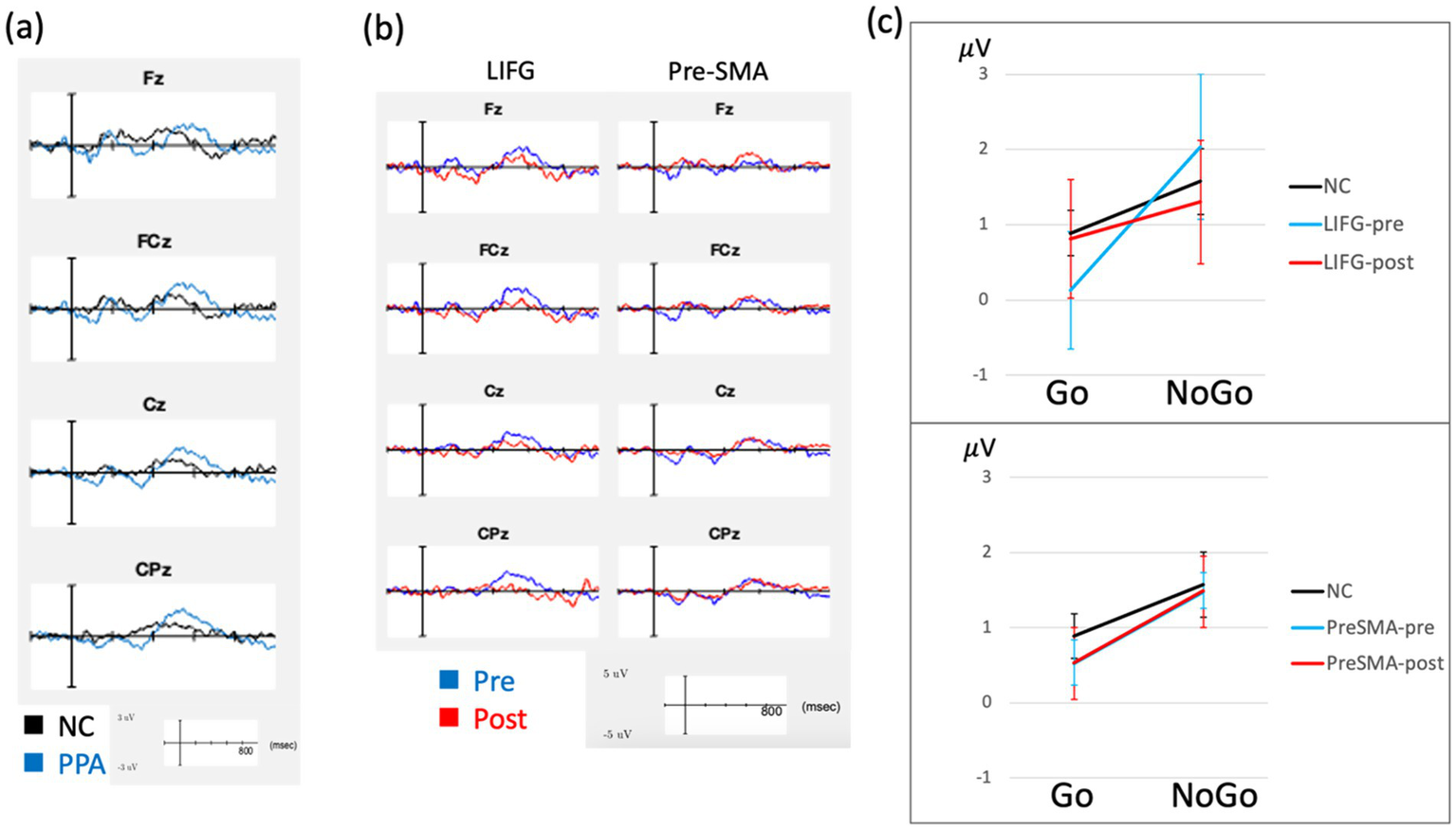 Graphs displaying EEG data and analysis results. Panel (a) shows waveforms for NC (black) and PPA (blue) across electrodes Fz, FCz, Cz, and CPz. Panel (b) compares LIFG and Pre-SMA data, highlighting Pre (blue) and Post (red) conditions with electrodes Fz, FCz, Cz, and CPz.Panel (c) presents line graphs with error bars showing mean amplitudes for Go and NoGo tasks. The top graph compares NC, LIFG-pre, and LIFG-post; the bottom graph compares NC, PreSMA-pre, and PreSMA-post.