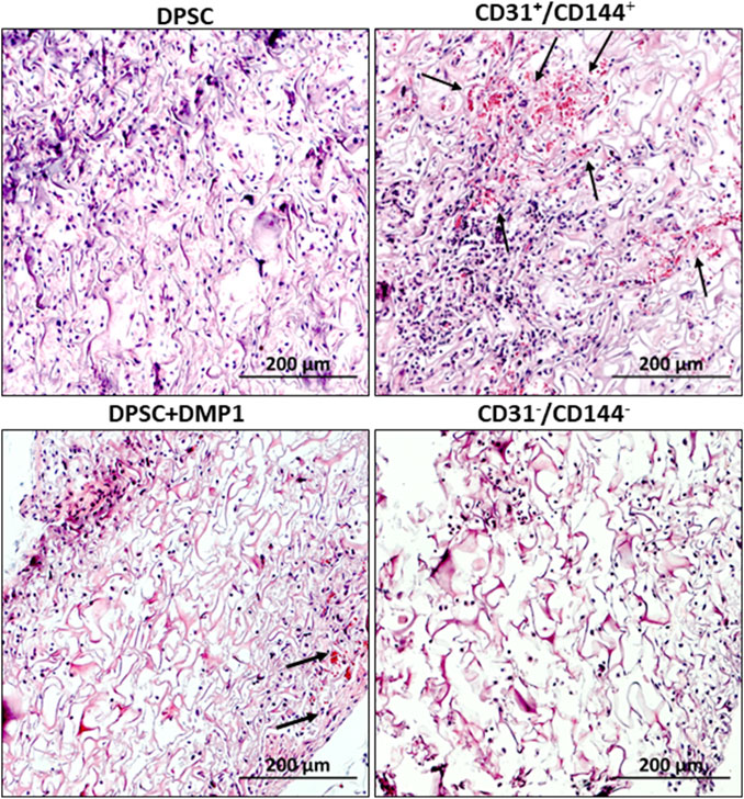 Four microscopy images labeled DPSC, CD31⁺/CD144⁺, DPSC