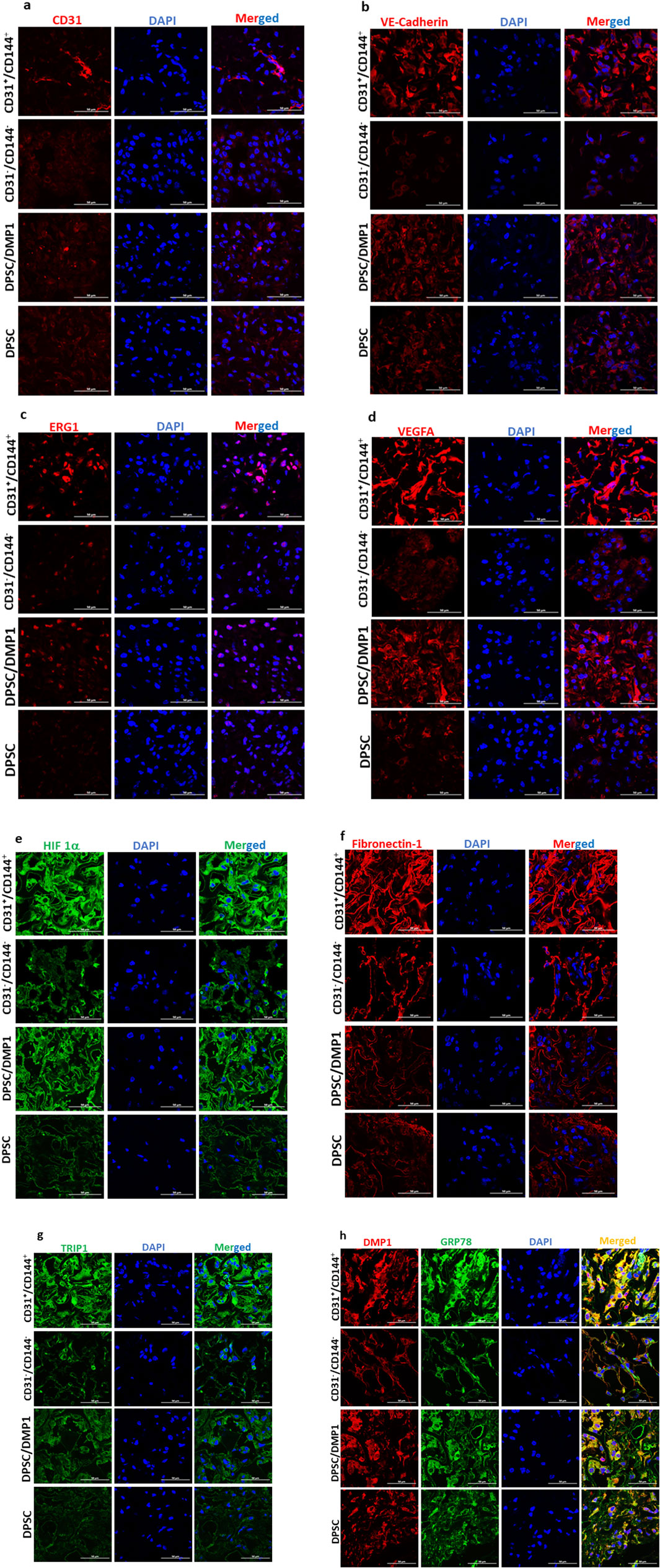 Fluorescence microscopy images divided into four panels (a, b, c, d), each containing four rows of three images. Each row shows cells stained with different markers: CD31, VE-Cadherin, ERG1, and VEGFA, followed by DAPI staining for nuclei, and a merged image. The rows represent different cell types: CD31⁺/CD144⁺, CD31⁻/CD144⁻, DPSC/DMP1, and DPSC. Red and blue staining indicates the presence of specific proteins and nuclear material, respectively. Scale bars are included in each image. Fluorescence microscopy panels depicting various protein expressions in cells, labeled as e, f, g, and h. Each panel shows three columns: protein staining, DAPI staining, and a merged image. Proteins include HIF 1α, Fibronectin-1, TRIP1, and DMP1. DAPI stains nuclei in blue. Different cell groups are labeled on the left including CD31/CD144, DPSC/DMP1, and DPSC. Each set highlights protein localization and intensity differences among the cell types.