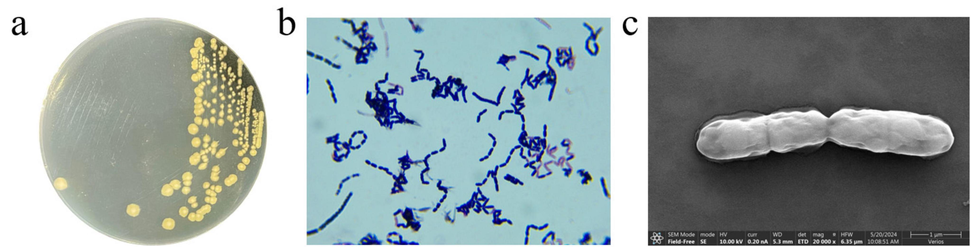 a) Petri dish with yellow bacterial colonies on a clear agar surface. b) Light microscope image of blue-stained, rod-shaped bacteria under magnification. c) Scanning electron microscope image of a single, elongated bacterium with a smooth surface.