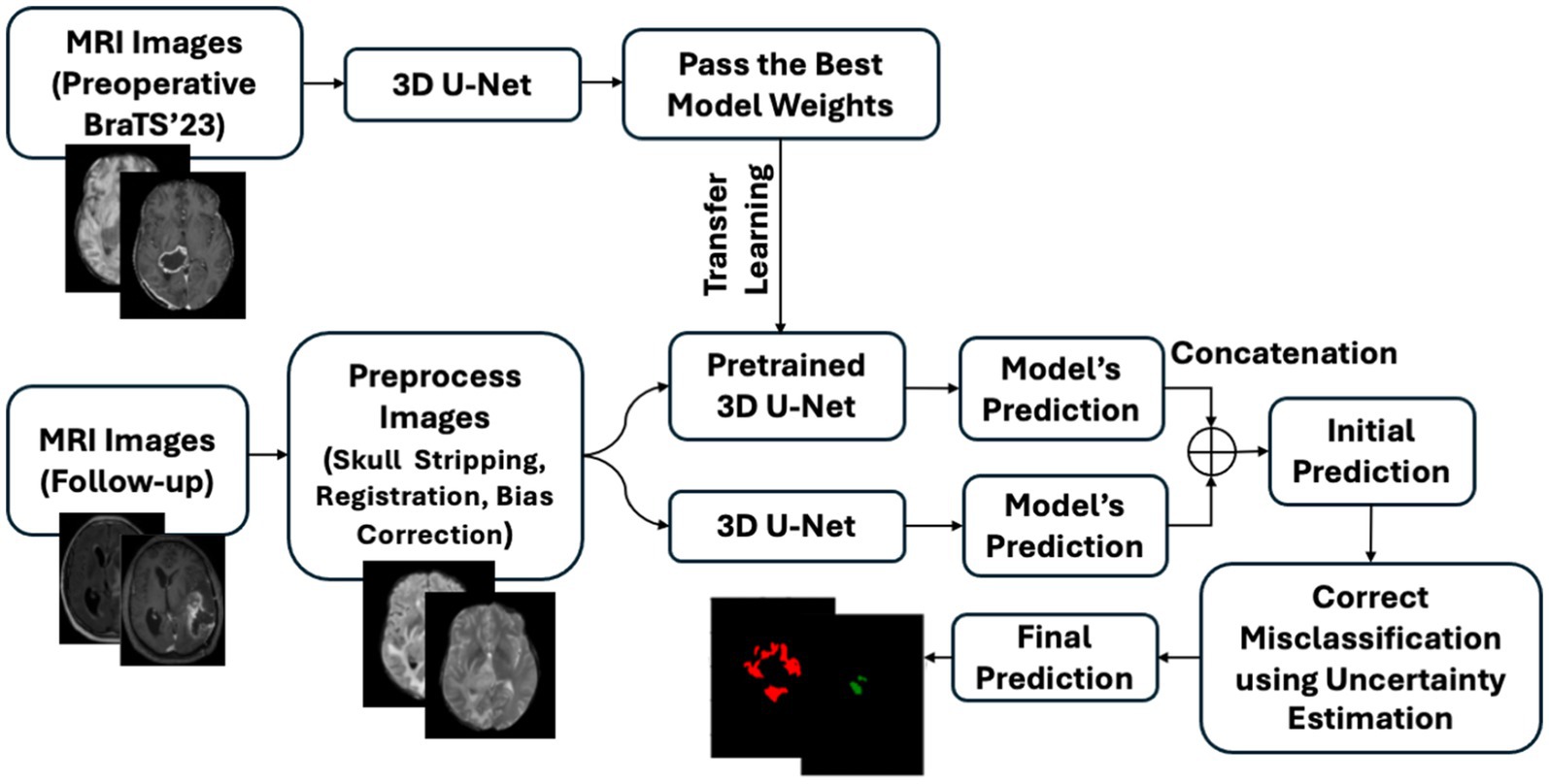Flowchart depicting a process for MRI image analysis using 3D U-Net. Preoperative MRI images are processed with 3D U-Net to pass the best model weights for transfer learning. Follow-up MRI images undergo preprocessing steps like skull stripping, registration, and bias correction. These images are then processed by a pretrained 3D U-Net and a 3D U-Net to generate predictions. Predictions are concatenated into an initial prediction, which is refined using uncertainty estimation to correct misclassification for a final prediction.