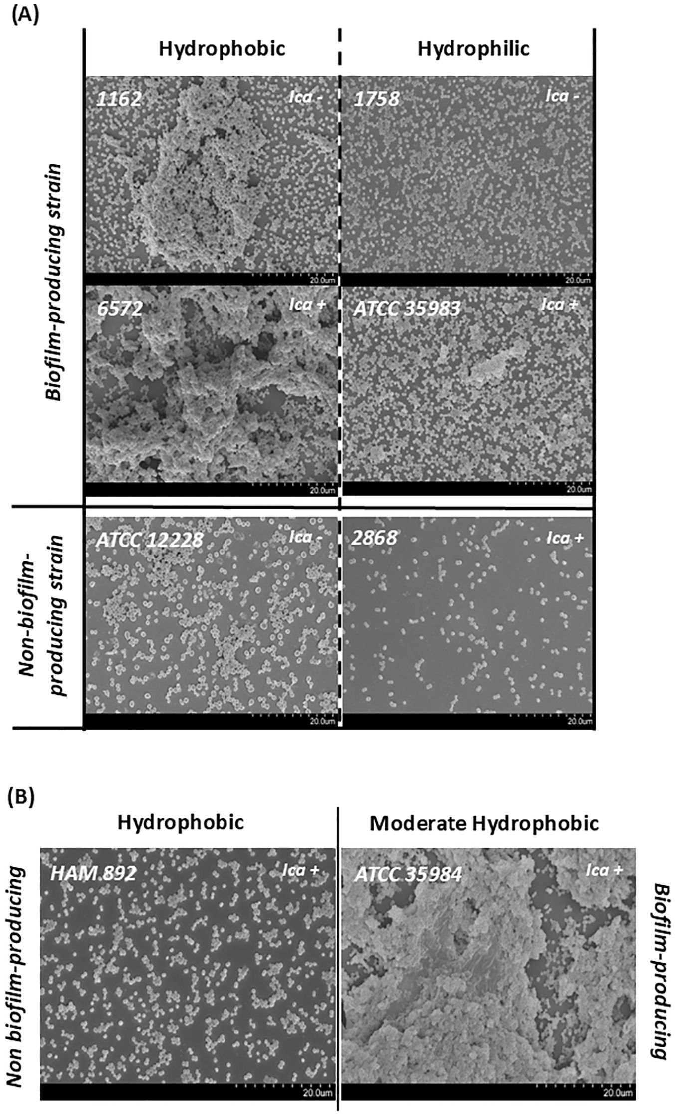 Panel A shows a comparison of biofilm and non-biofilm-producing bacterial strains on hydrophobic and hydrophilic surfaces. Micrographs depict strains 1162 and 6572 on hydrophobic surfaces, and strains 1758 and ATCC 35983 on hydrophilic surfaces. Strains ATCC 12228 and 2868 represent non-biofilm producers on respective surfaces. Panel B shows hydrophobic and moderate hydrophobic conditions for non-biofilm-producing strain HAM.892 and biofilm-producing strain ATCC 35984. Scale bars are 20 micrometers.