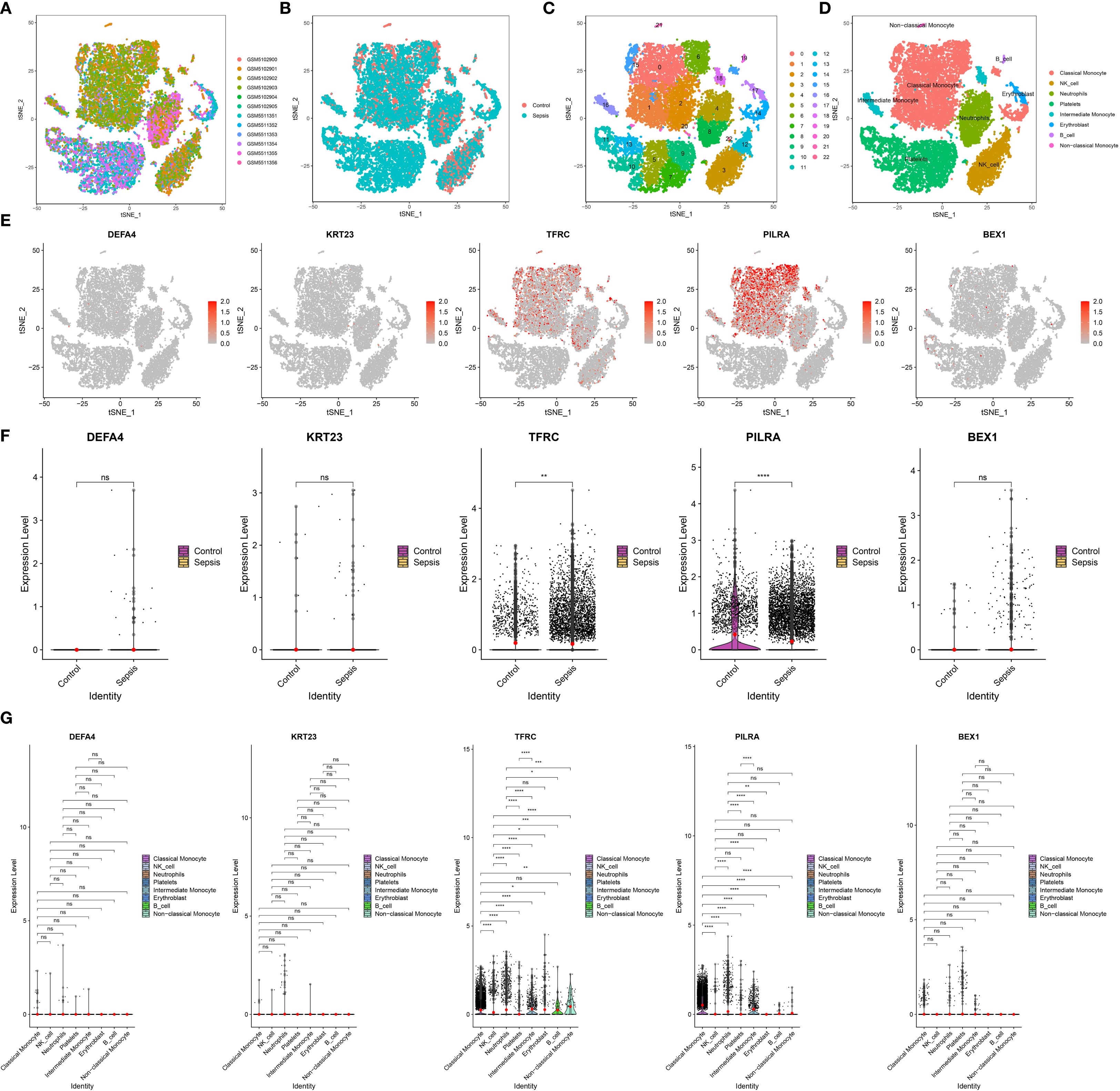 Panel A to D display t-SNE plots of cell clusters. Panel E shows feature plots for DEFA4, KRT23, TFRC, PILRA, and BEX1 gene expressions. Panel F presents box plots comparing gene expression levels between control and sepsis groups. Panel G displays violin plots showing expression levels by cell identity, differentiating classical, intermediate, and non-classical monocytes. Data visualization highlights significant differences in gene expressions across various groups and conditions.