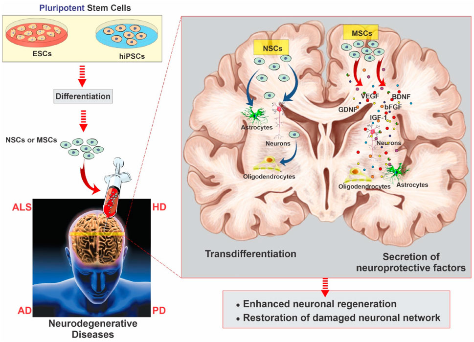 Diagram illustrating the differentiation of pluripotent stem cells (ESCs and hiPSCs) into neural stem cells (NSCs) or mesenchymal stem cells (MSCs) for treating neurodegenerative diseases like ALS, HD, AD, and PD. NSCs transdifferentiate into neurons, astrocytes, and oligodendrocytes, while MSCs secrete neuroprotective factors like VEGF, BDNF, GDNF, bFGF, and IGF-1. This process aims to enhance neuronal regeneration and restore damaged neuronal networks, shown in the context of a brain.