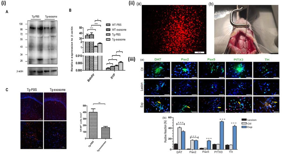 (i) Group of images and graphs depicting protein expression and staining in biological samples. Panel A shows a Western blot, and panel B presents a bar graph comparing relative expression levels of Bdnf and Syp proteins across different treatments. Panel C includes stained tissue sections and a bar graph illustrating cell counts.(ii) Two images. (a) Shows fluorescent red-stained cells under a microscope. (b) Displays a surgical procedure on an animal.(iii) Series of fluorescently stained tissue images to indicate protein markers such as DAT, Pax2, Pax5, PITX3, and TH across different conditions, alongside a bar graph showing positive reaction percentages.