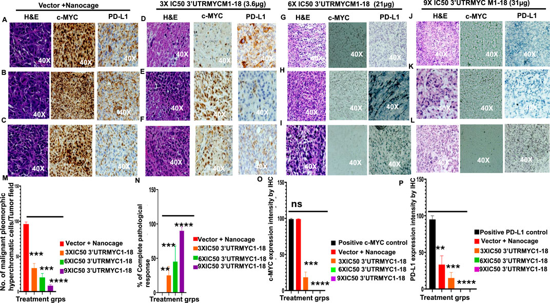 Microscopic images and bar charts analyzing treatment effects. Panels A-L show H&E, c-MYC, and PD-L1 stained tissue samples under different treatments with labels indicating magnification. Panels M-P display bar graphs comparing the number of malignant cells, complete pathological response percentage, c-MYC, and PD-L1 expression intensity among treatment groups. Statistical significance is marked by asterisks.