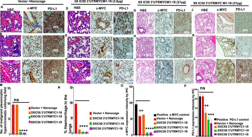 Histological and immunohistochemical analysis comparing H&E, c-MYC, and PD-L1 staining across different treatments of lung tissues at 40X magnification. Sections A-L show stained tissue samples with variations in expression and morphology under