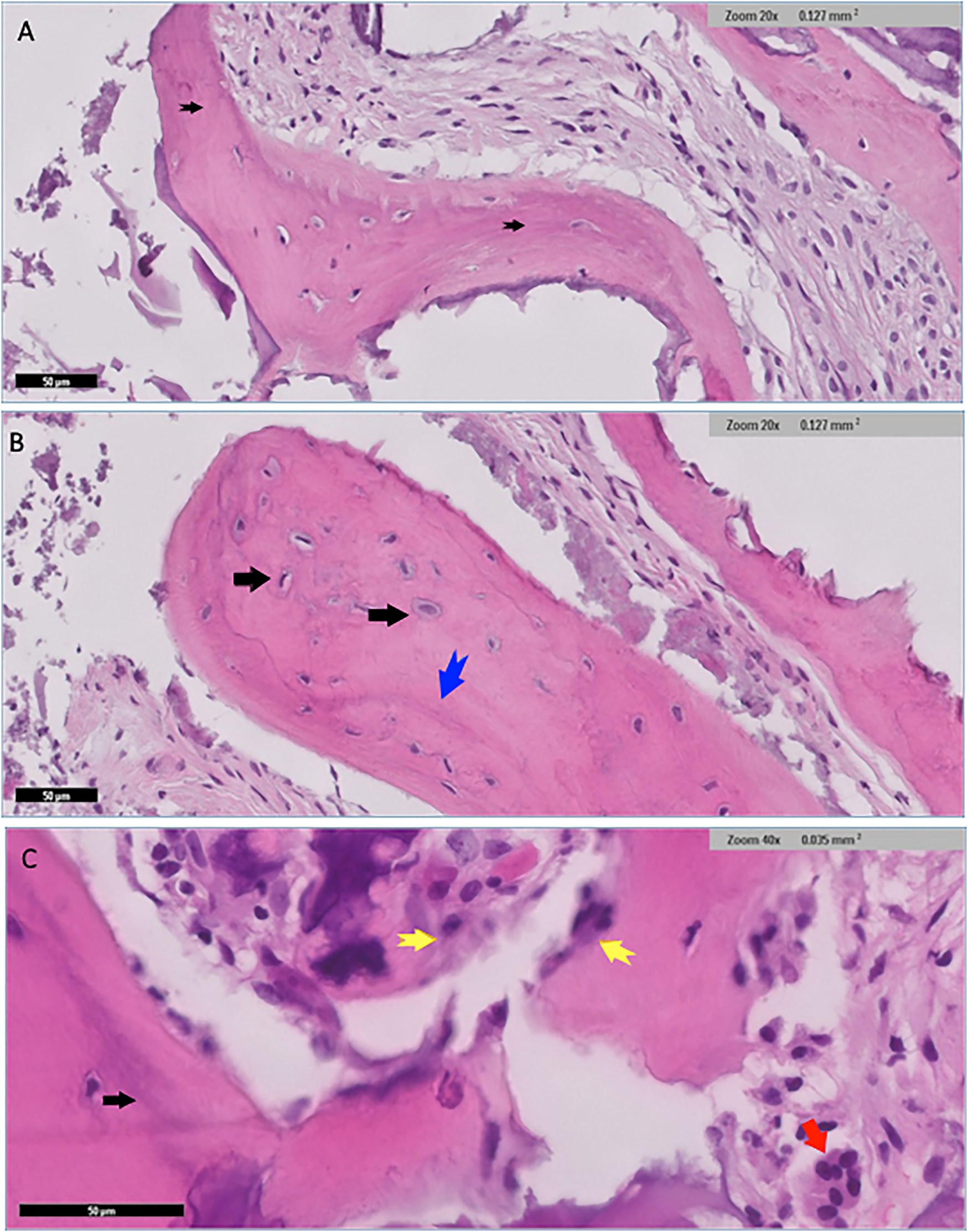 Histological images of bone tissue in three panels labeled A, B, and C. Panel A shows lamellar bone (pink) with cellular structures indicated by black arrows. Panel B shows compact bone, with structural details highlighted by black and blue arrows. Panel C reveals cellular detail, with osteocytes and lacunae indicated by black, yellow, and red arrows. Magnification ranges from twenty to forty times with scales provided.