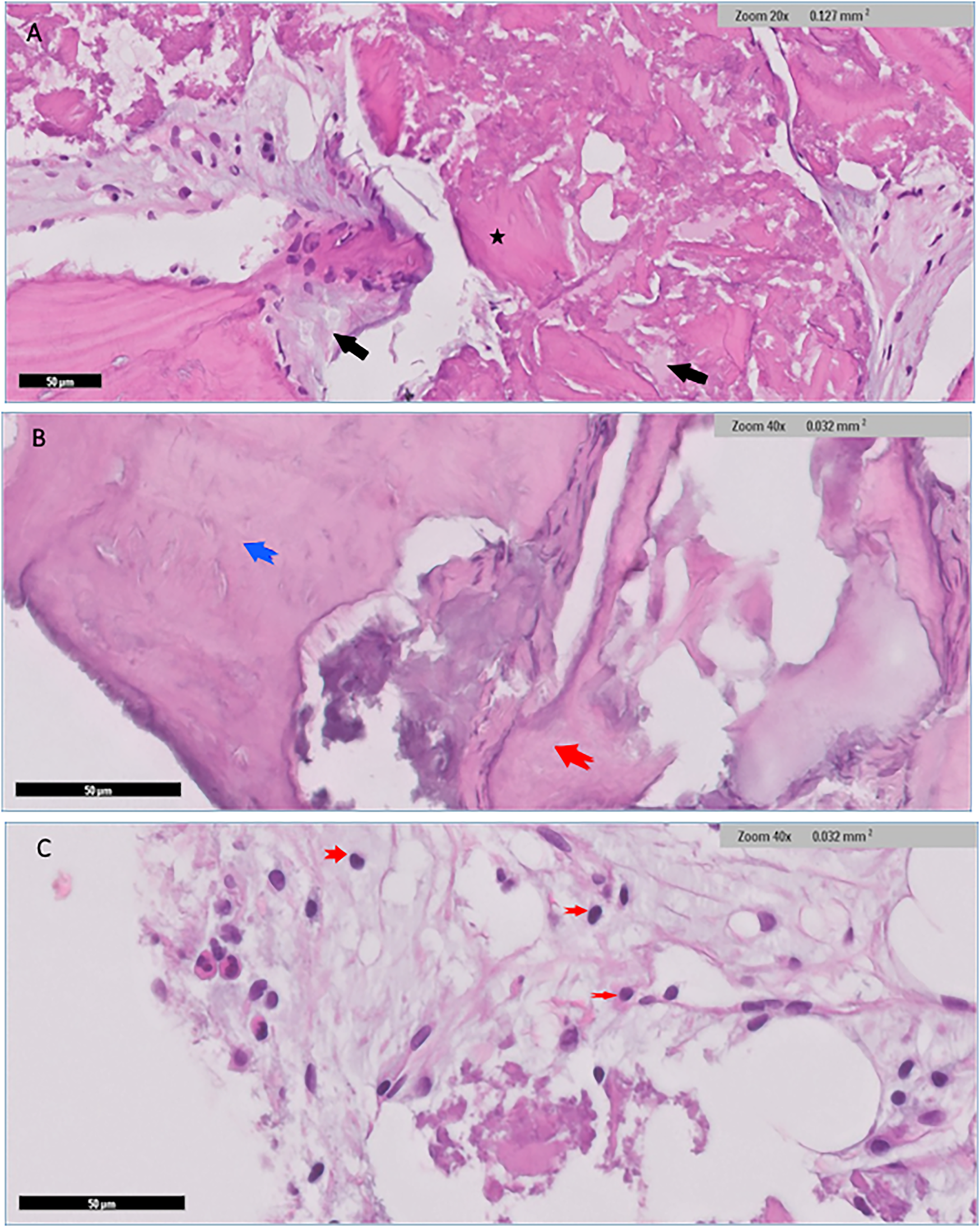 Three panels of histological images stained with hematoxylin and eosin. \n\nPanel A shows tissue with darkly stained nuclei, including a distinct black star and black arrows indicating specific areas at twenty times magnification. \n\nPanel B displays similar stained tissue at higher magnification (forty times), with a red arrow highlighting a particular structure and a blue arrow pointing to another feature.\n\nPanel C also at forty times magnification, highlights cellular details with smaller red arrows indicating specific areas, focusing on tissue structure and cell arrangement. Each panel includes a scale bar.