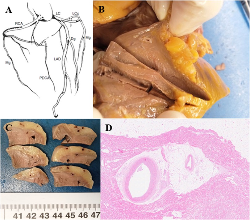 Diagram A shows coronary arteries with labels. Image B is a dissected heart showing internal structure. Image C displays several heart tissue cross-sections next to a ruler. Image D is a microscopic view of a blood vessel stained pink.