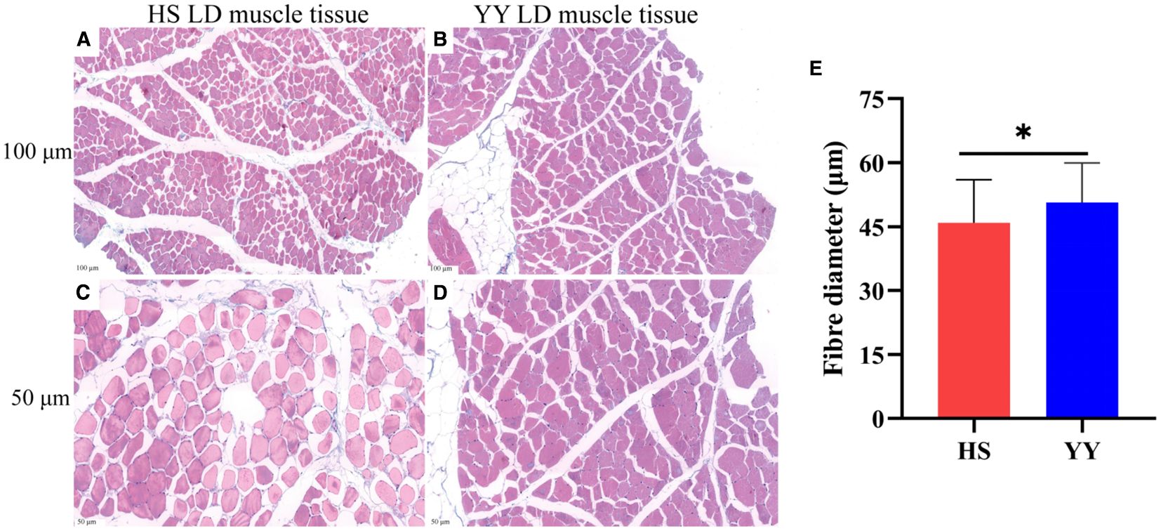 Histological sections show LD muscle tissue from HS (A, C) and YY (B, D) samples at 100 micrometers and 50 micrometers magnification. A bar chart (E) compares fiber diameter, indicating larger fibers in YY, with a statistically significant difference marked by an asterisk.