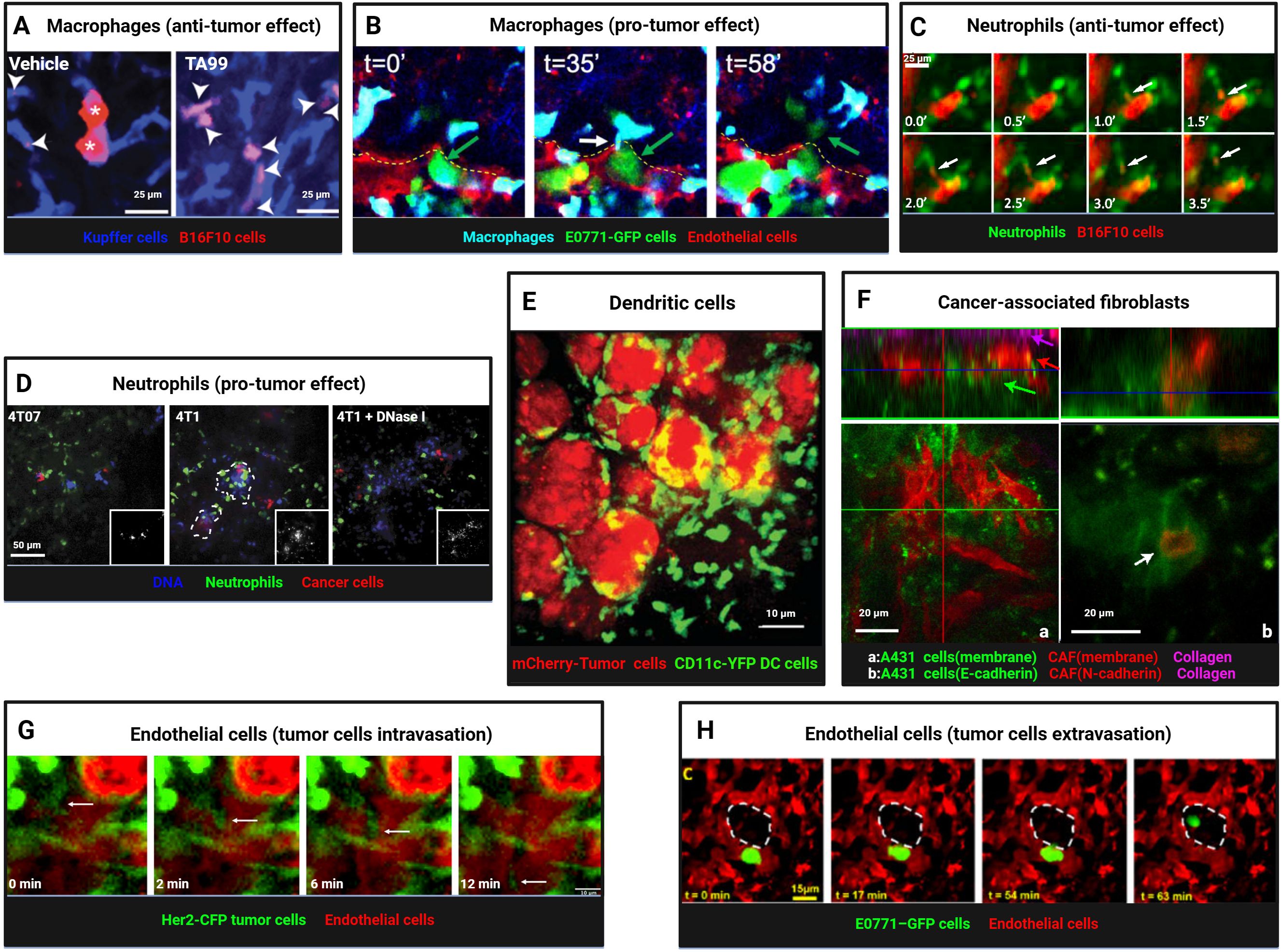 Composite image displaying effects of various cell types on tumors. A: Macrophages showing anti-tumor effects in two conditions. B: Macrophages indicating pro-tumor effects over time. C: Time-lapse of neutrophils with anti-tumor effects. D: Neutrophils demonstrating pro-tumor effects in different conditions. E: Dendritic cells interacting with mCherry-Tumor and CD11c-YFP DC cells. F: Cancer-associated fibroblasts visualized with collagen and cell membranes. G: Endothelial cell-mediated tumor cell intravasation observed over time. H: Endothelial cells depicting tumor cell extravasation over time. Each panel highlights specific cellular interactions using fluorescent markers.