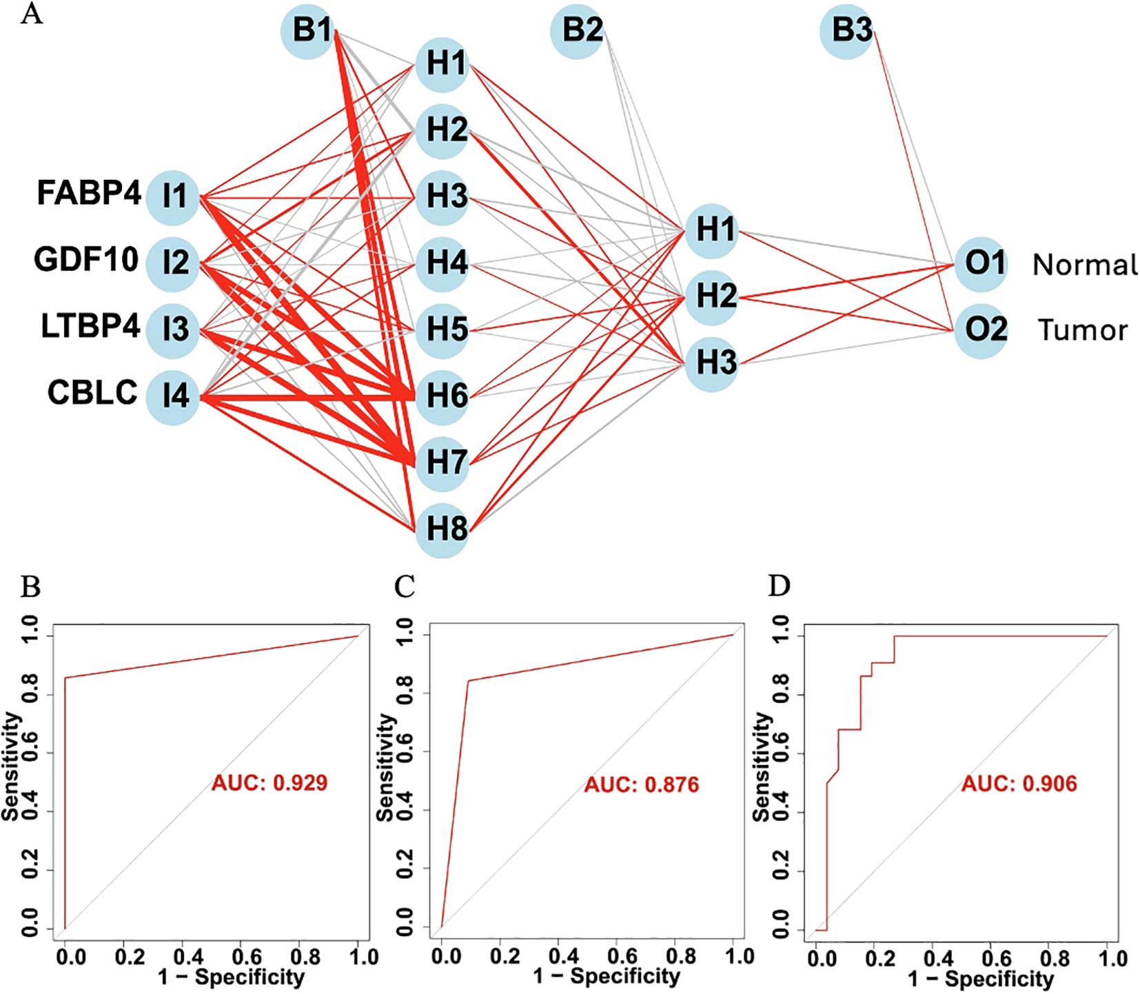 Network diagram (A) illustrates interactions among FABP4, GDF10, LTBP4, and CBLC with pathways to normal tissues and tumor. ROC curves (B, C, D) show diagnostic performance with AUC values of 0.929, 0.876, and 0.906, indicating high sensitivity and specificity.