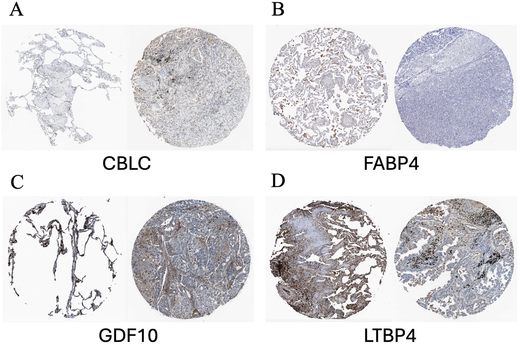 Histological images labeled A through D, each showing tissue samples stained to highlight protein expression. A displays CBLC, B shows FABP4, C illustrates GDF10, and D exhibits LTBP4. Each panel contains detailed cellular structures with varying levels of staining intensity.