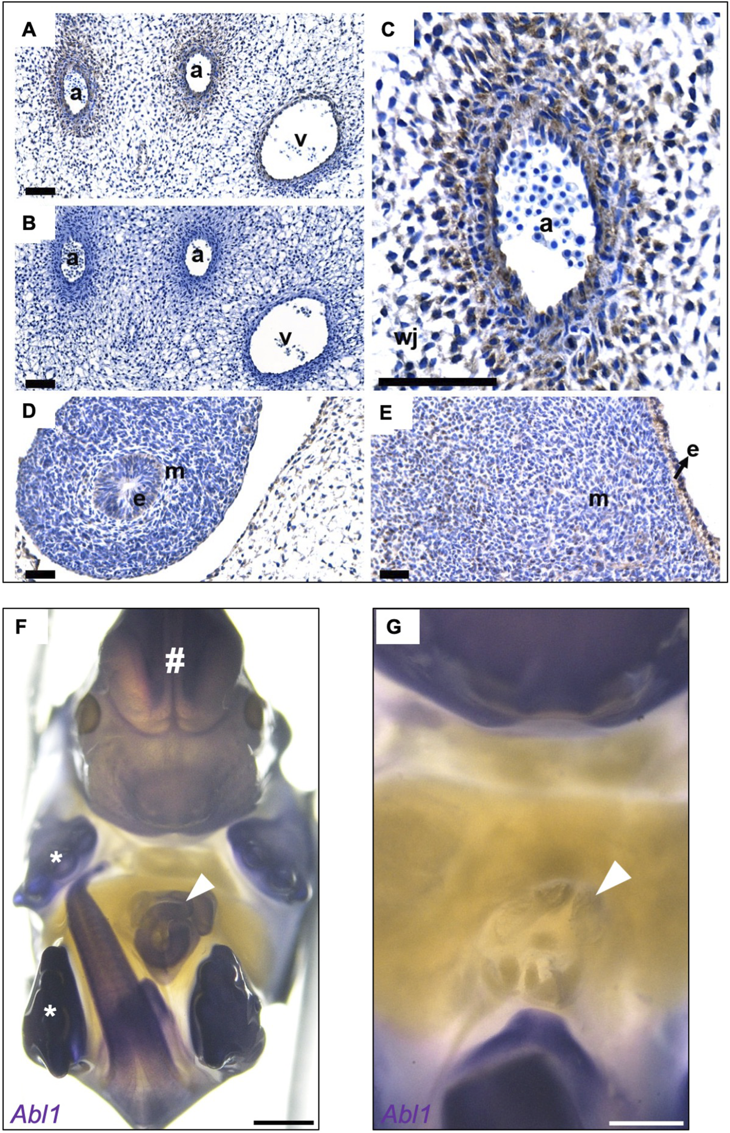 Histological images show cross-sections of tissue and cellular structures. Panels A and B display vascular sections labeled "a" and "v," denoting arteries and a vein. Panel C is a close-up of an artery with surrounding cells. Panels D and E depict muscle (m) and epidermal (e) tissues. Panel F presents a top view of a stained specimen highlighting anatomical features with symbols like "#" and "*". Panel G focuses on the same area marked with a white arrowhead, labeled Abl1, indicating gene expression. Each panel provides insight into distinct biological structures.