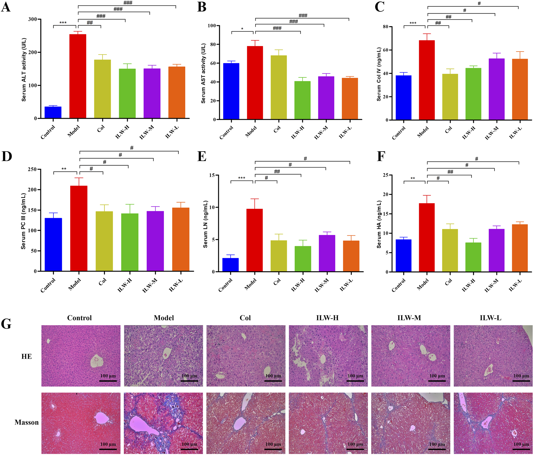 Bar charts (A-F) depict serum activity and content levels for ALT, AST, Col IV, PC III, LN, and HA across various groups: Control, Model, Col, and ILW in high, medium, and low doses. The Model group generally shows elevated levels, with significant differences indicated by asterisks and hash marks. Panel G shows histological images of liver tissues in HE and Masson stainings for the same groups, highlighting tissue structure and fibrosis. Each micrograph is labeled with a scale bar of one hundred micrometers.