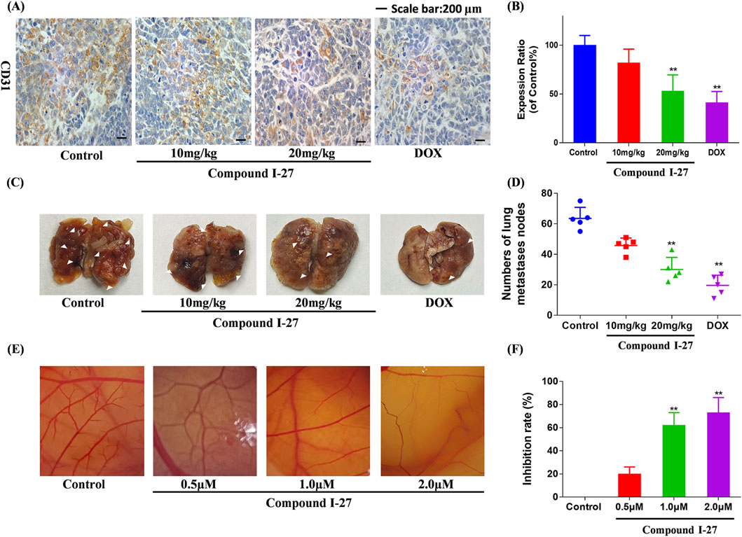 Panel (A) shows histological images of tissue samples stained for CD31 under control, 10 mg/kg, 20 mg/kg Compound I-27, and DOX conditions. Panel (B) presents a bar graph comparing expression ratios, showing a decrease with treatment. Panel (C) displays lung metastases under the same conditions with visible nodules. Panel (D) is a scatter plot depicting the number of lung metastases nodes, showing reduction with treatment. Panel (E) includes images of blood vessels in tissues treated with varying concentrations of Compound I-27. Panel (F) features a bar graph illustrating the inhibition rate, increasing with higher concentrations. Scale bar in (A) is 200 micrometers.