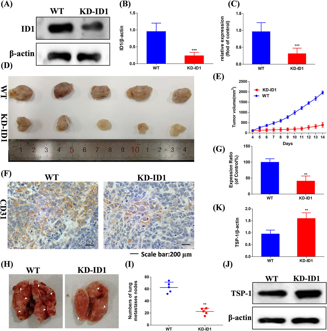 (A) A Western blot image showing ID1 and β-actin protein levels for WT and KD-ID1. (B, C, G, K) Bar graphs displaying differences in protein expression ratios and other metrics between WT and KD-ID1, indicating significant differences. (D) Photograph of tumor samples from WT and KD-ID1 groups, arranged with a ruler for scale. (E) Line graph comparing tumor volume over time for WT and KD-ID1, showing slower growth in KD-ID1. (F) Histological comparison of CD31 staining in WT and KD-ID1 tissues, with scale bar indicating 200 micrometers. (H) Images of lungs with metastatic nodules for WT and KD-ID1. (I) Scatter plot comparing the number of lung metastasis nodes between WT and KD-ID1. (J) Western blot image showing TSP-1 and β-actin protein levels for WT and KD-ID1.