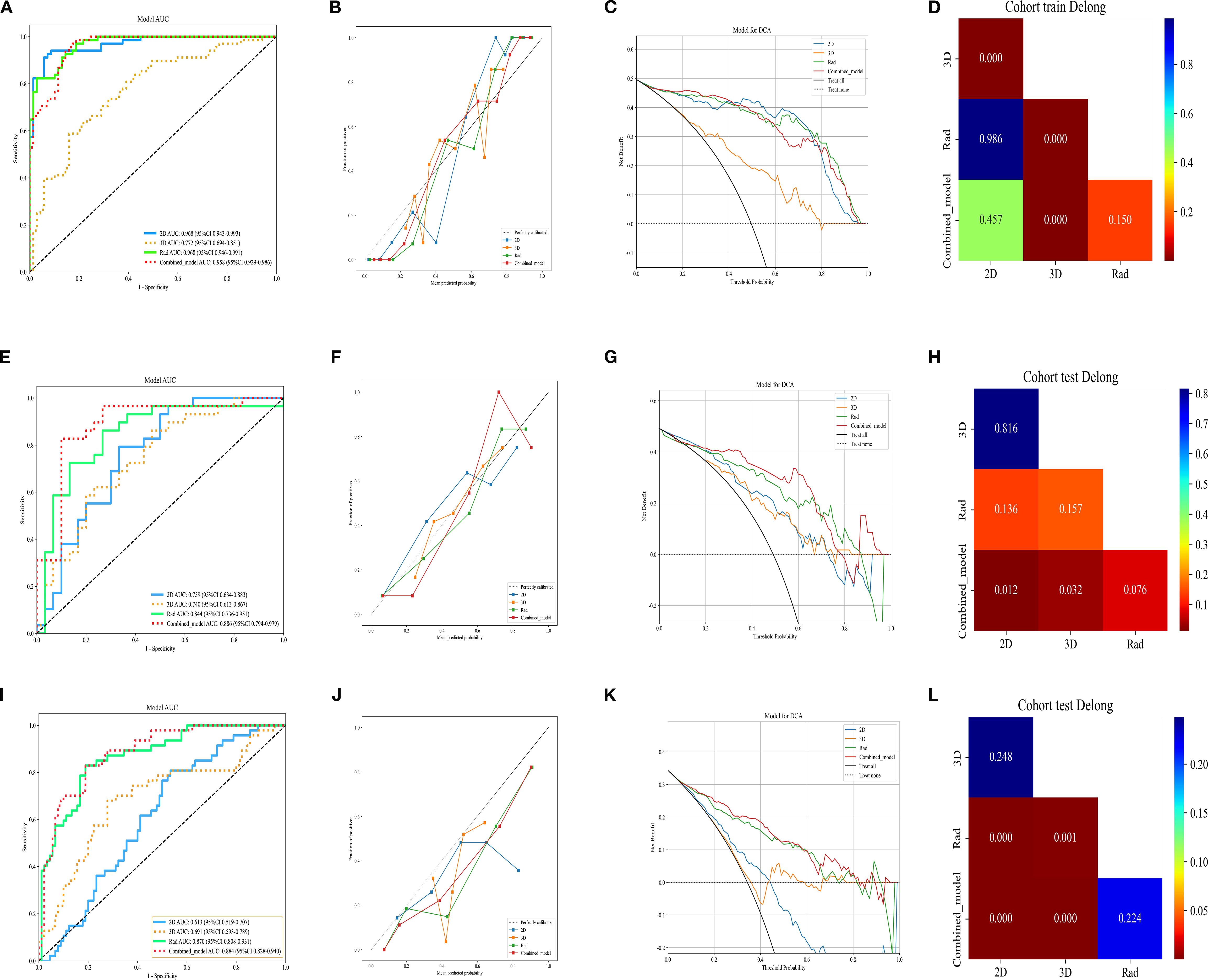 A series of panels depicting statistical analyses. Panels A, E, and I show ROC (Receiver Operating Characteristic) curves comparing different models. Panels B, F, and J present calibration plots for the models. Panels C, G, and K illustrate decision curve analyses, highlighting model performance across different thresholds. Panels D, H, and L include Cohort DeLong test results, represented by color intensity ranging from blue to red. Each figure panel is labeled and organized in a grid format for comparison.