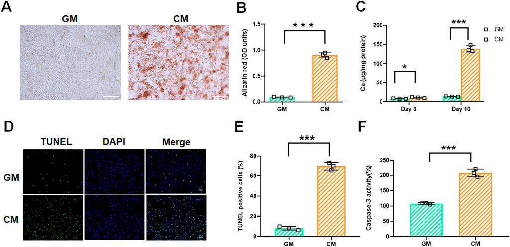 Images display GM and CM cell comparisons:A) Microscopic images of GM and CM cells, showing more Alizarin red staining in CM.B) Bar graph showing higher Alizarin red levels in CM than GM.C) Bar graph with elevated calcium in CM on Day 10 compared to GM.D) Fluorescent images with TUNEL and DAPI staining, showing more apoptosis in CM.E) Bar graph with increased TUNEL-positive cells in CM.F) Bar graph with higher caspase-3 activity in CM than GM, indicating more cell death. *** indicates significant differences.