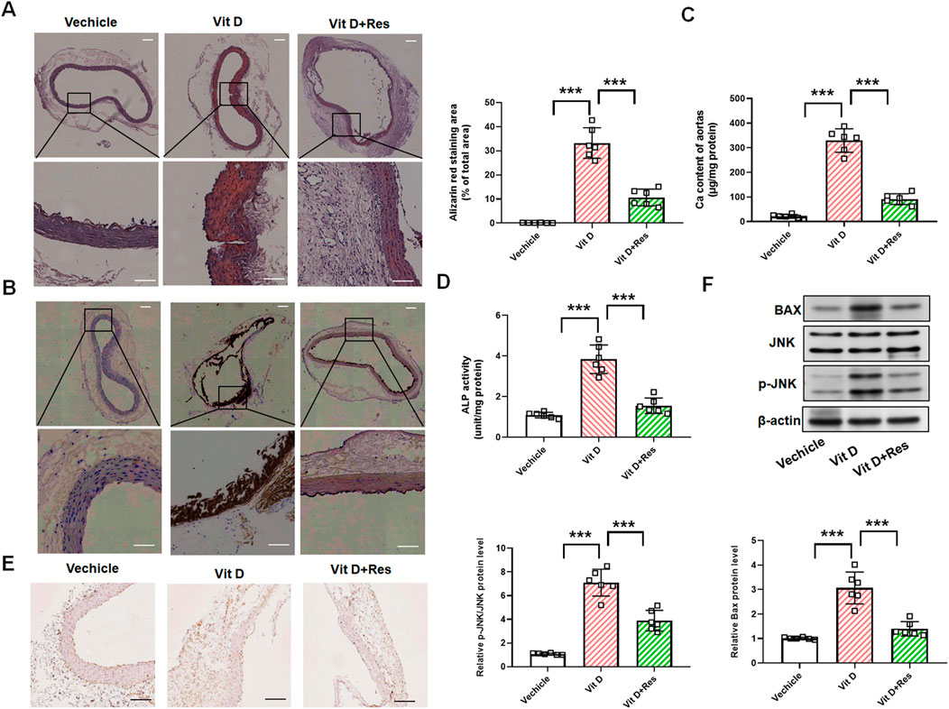 Histological and biochemical analysis of aortic tissues and protein expression across different treatments. Panels A and B show histological staining with focus on areas of interest. Panel C includes bar graphs of alizarin red staining and calcium content, with significant differences marked by asterisks. Panel D displays bar graphs of ALP activity and related protein levels, also showing significant differences. Panel E shows further histological samples comparing treatments. Panel F presents a protein expression analysis with bands for BAX, JNK, p-JNK, and β-actin under different treatments.