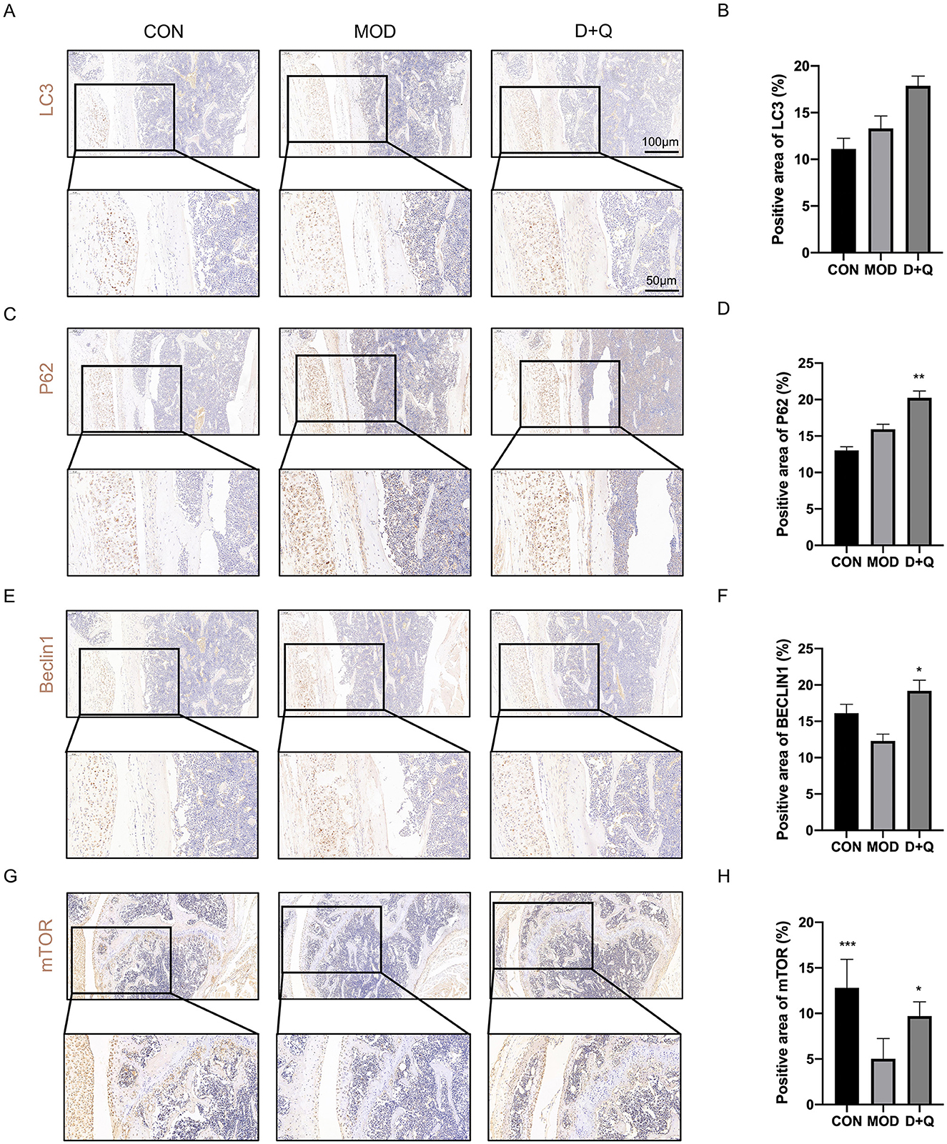 Histological analysis of tissue samples labeled as LC3, P62, Beclin1, and mTOR across three conditions: CON, MOD, and D+Q. Each panel includes magnified images showing specific areas of staining. Adjacent bar graphs (B, D, F, H) compare the positive area percentages for each marker across conditions, indicating statistical differences with asterisks.