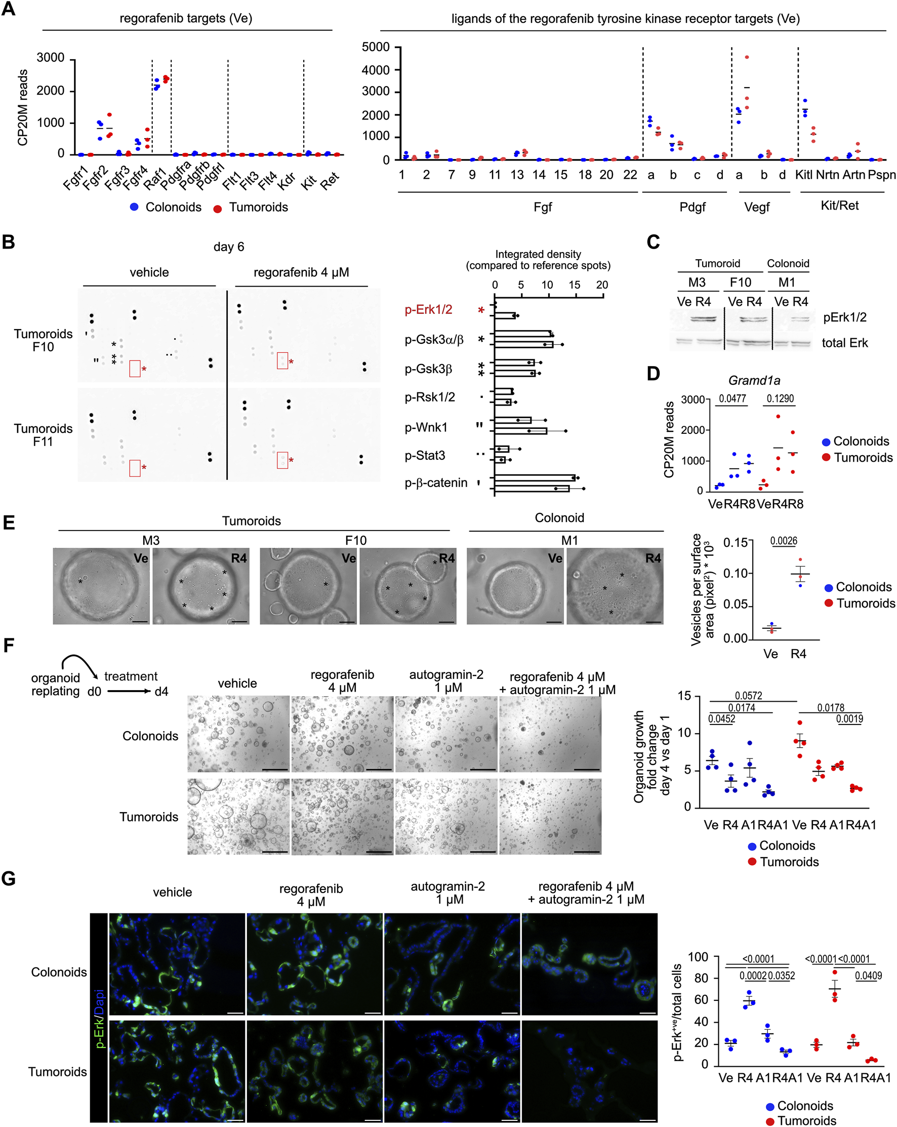 Data visualization and image of experimental results display the effects of regorafenib on colonoids and tumoroids. Graphs and charts analyze gene expression and kinase activity, showing comparative data between vehicle-treated and regorafenib-treated samples. Microscopic images of organoid morphology illustrate differences in response to treatment. Statistical significance is highlighted in accompanying plots.