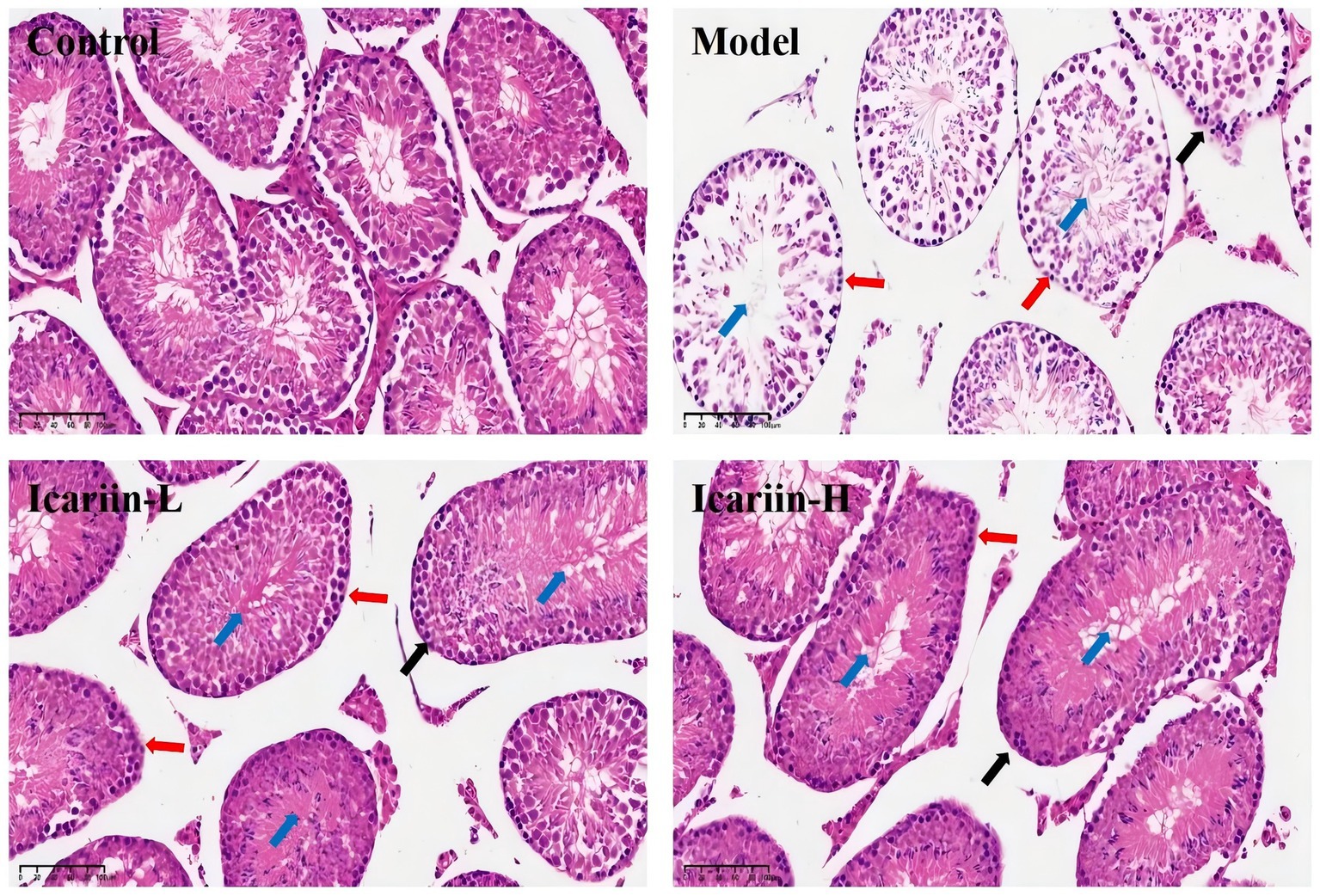 Histological images of testicular tissues from four groups: Control, Model, Icariin-L, and Icariin-H. Control shows dense, uniform seminiferous tubules. Model exhibits irregular structures and less density. Icariin-L and Icariin-H images show varying degrees of structure restoration and density. Each image includes arrows highlighting specific features for comparison.