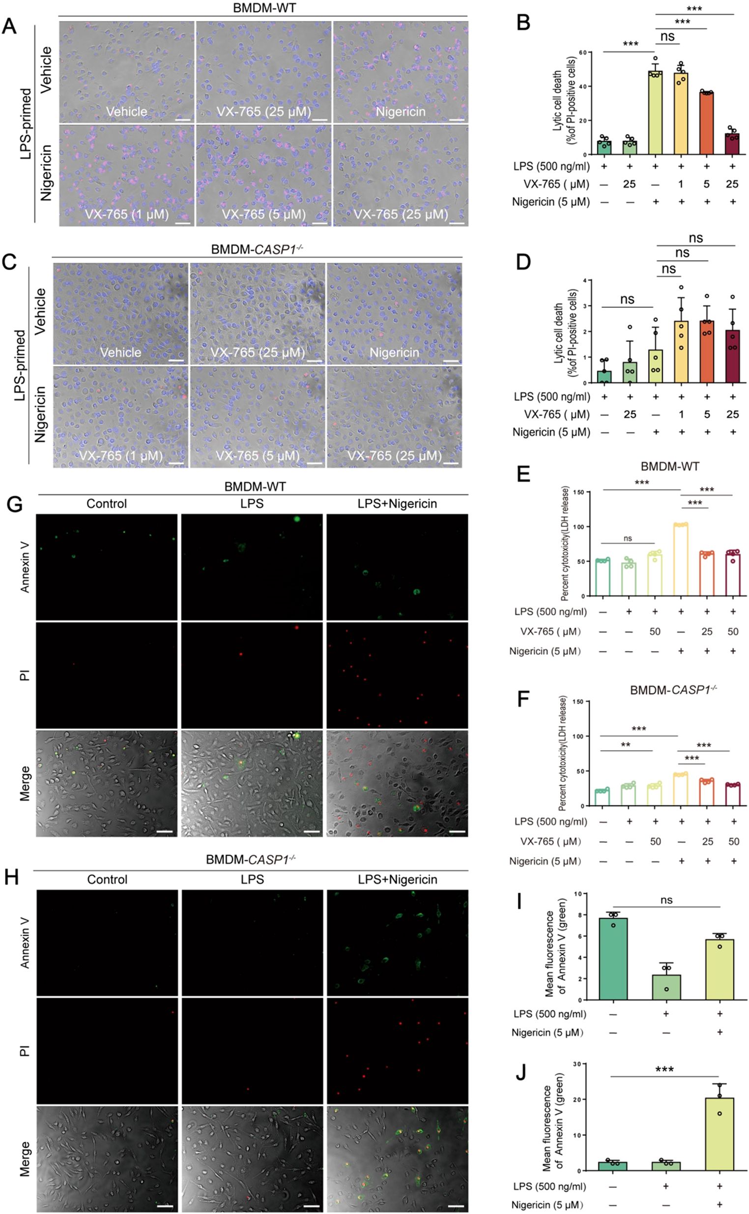 A series of scientific images and bar graphs illustrating the effects of VX-765 and Nigericin on BMDM-WT and BMDM-CASP1^- cells. Panels A, C, G, and H show microscopic images of cells under various treatments, highlighting cell morphology changes. Panels B, D, E, F, I, and J contain bar graphs depicting the percentage of lytic cell death and LDH release under different conditions, with significance indicated by asterisks. The images and charts jointly show the experimental data on cell death and apoptosis assays.