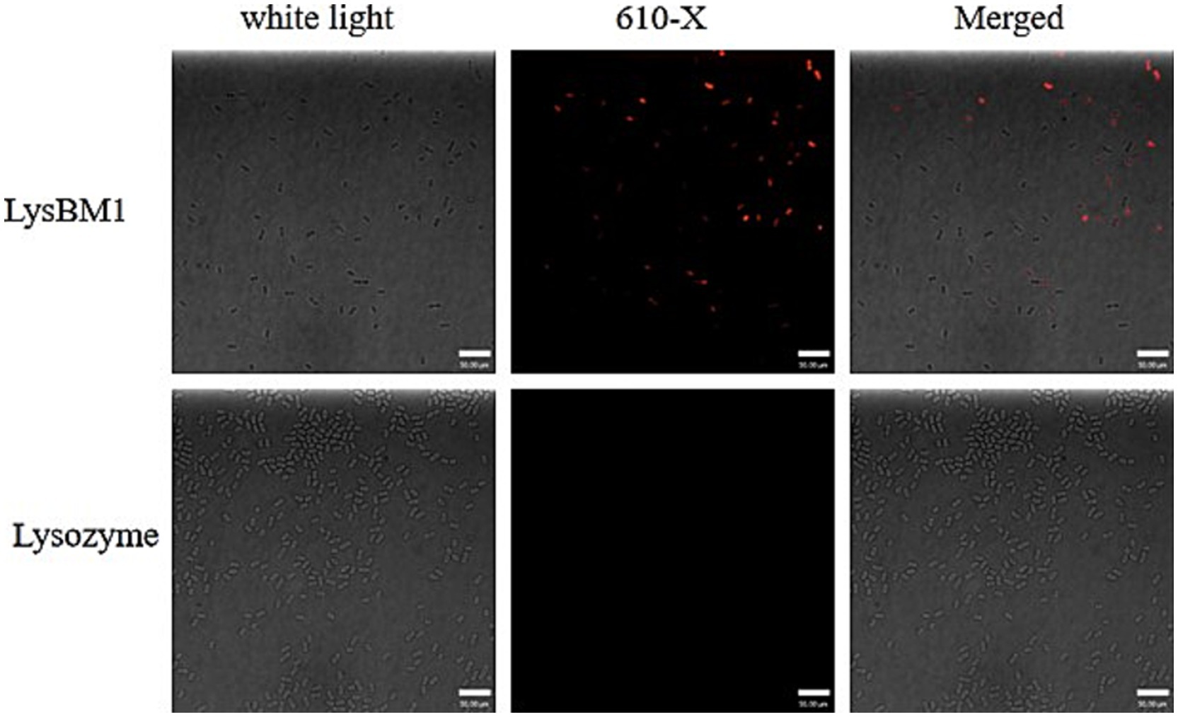 Microscopic imaging of bacterial samples. The top row shows LysBM1 with white light, 610-X fluorescence highlighting red spots, and their merged view. The bottom row displays Lysozyme with white light, no fluorescence in 610-X, and the merged view. Each image shows a scale bar of 50 micrometers.