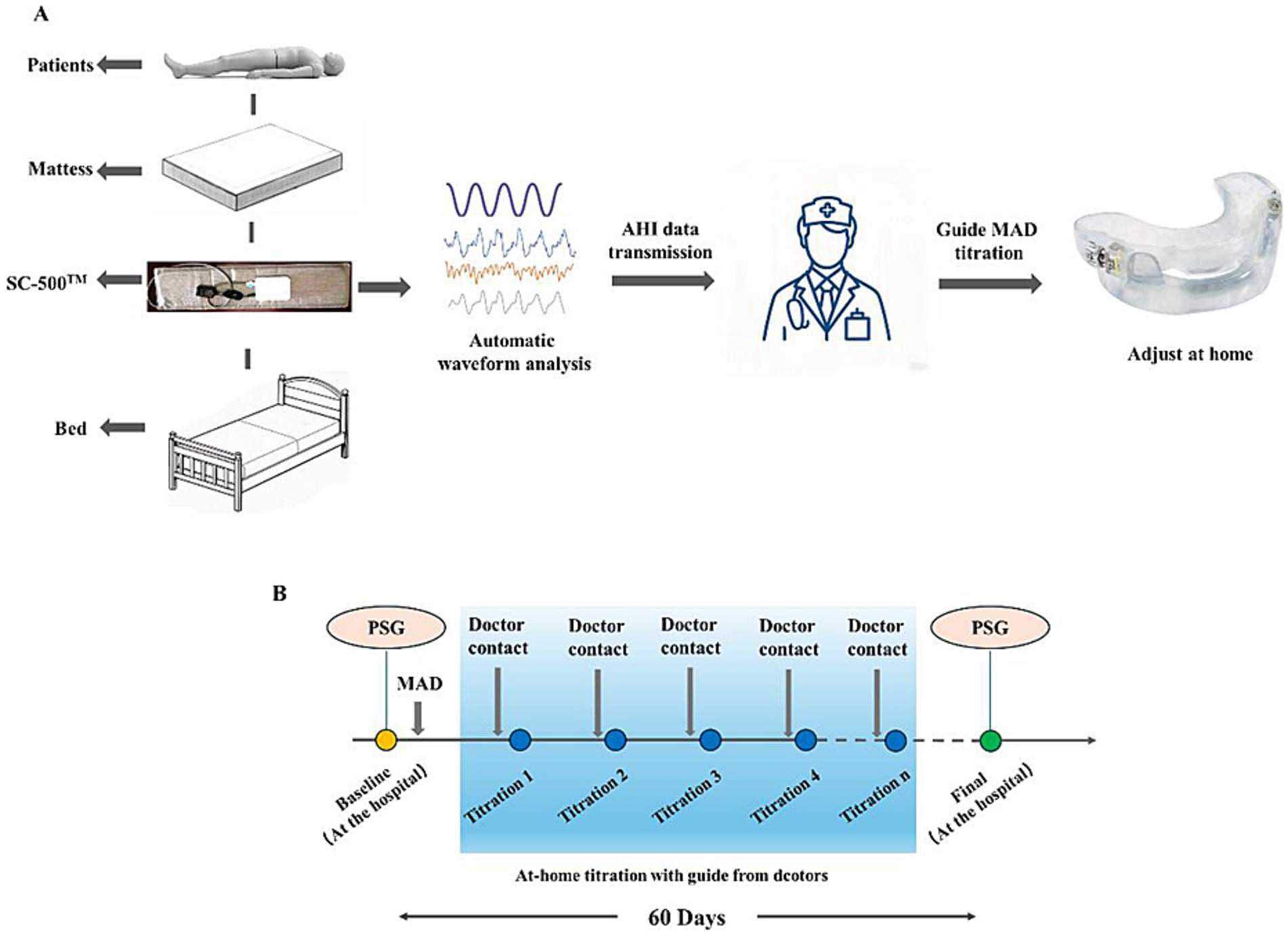 Diagram showing a process for sleep apnea management. Part A illustrates a sequential flow: a patient lies on a mattress with an SC-500â„¢ device analyzing waveforms, transmitting AHI data to a doctor, who guides MAD adjustments at home. Part B depicts a 60-day timeline for at-home titration with doctor contact at various stages: baseline at hospital, multiple titration stages, and a final hospital visit.