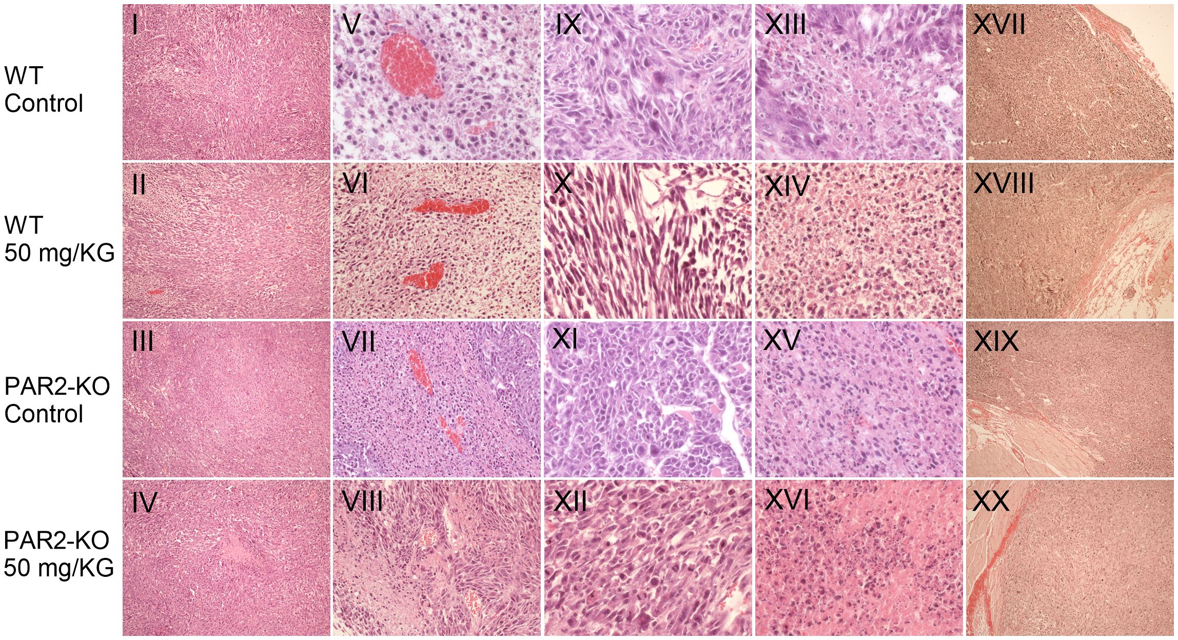 Grid of twenty stained tissue micrographs arranged in four rows and five columns. Each row is labeled: “WT Control,” “WT 50 mg/KG,” “PAR2-KO Control,” and “PAR2-KO 50 mg/KG,” with panels I to XX. Each panel shows variations in tissue structure and staining, possibly indicating differences in experimental conditions or treatments.