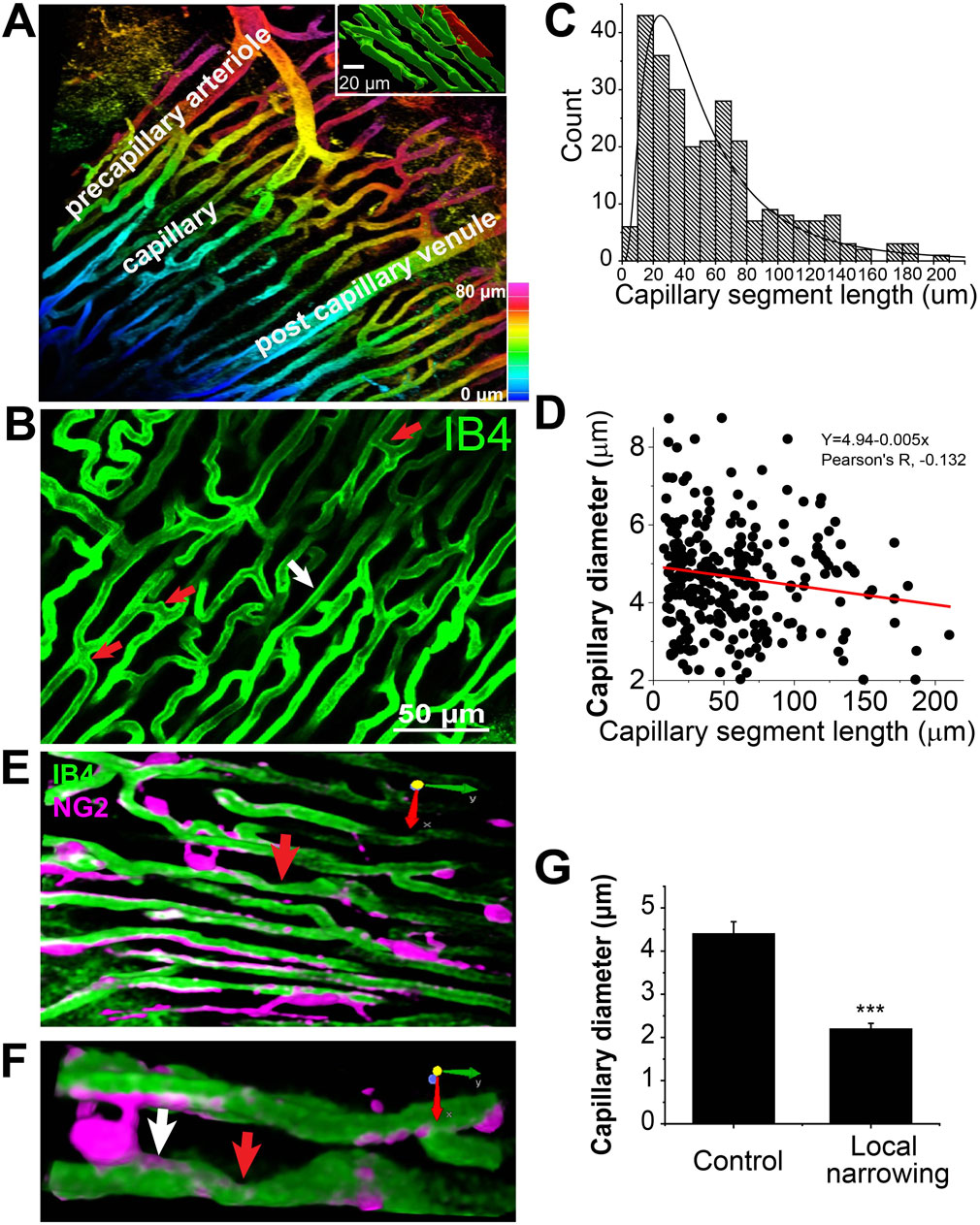 Diagram featuring images and graphs analyzing capillary segments. Panel A: Microscopic image showing precapillary arteriole, capillary, and postcapillary venule with color mapping of depth. Panel B: Green-stained capillaries, indicated by arrows. Panel C: Histogram of capillary segment lengths. Panel D: Scatter plot correlating capillary diameter and segment length. Panel E: Overlaid image of IB4 and NG2 markers, with arrows highlighting features. Panel F: Higher magnification of capillaries, red and white arrows point to specific areas. Panel G: Bar chart comparing capillary diameters between control and local narrowing groups, highlighting a significant decrease in the latter.