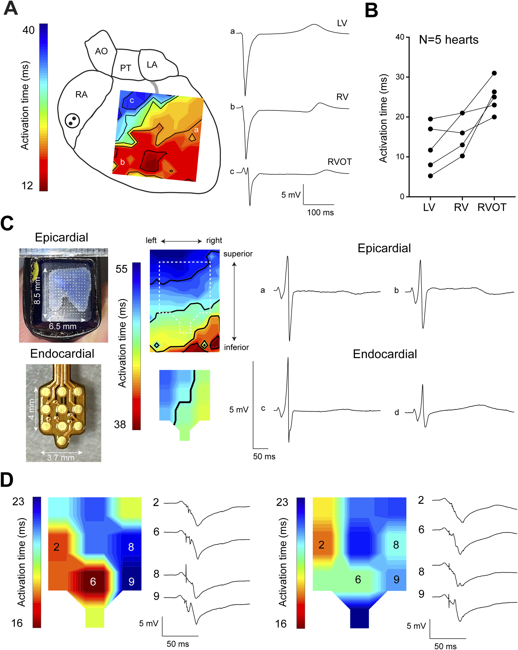 Panel A shows a heart diagram with an activation time map and corresponding electrogram traces for the left ventricle, right ventricle, and right ventricular outflow tract. Panel B displays a graph indicating activation times for five hearts, highlighting variability among the three regions. Panel C includes images of epicardial and endocardial electrode arrays, with activation maps and corresponding electrogram traces. Panel D presents two activation time maps with electrogram traces, showing measurements at different electrode sites.