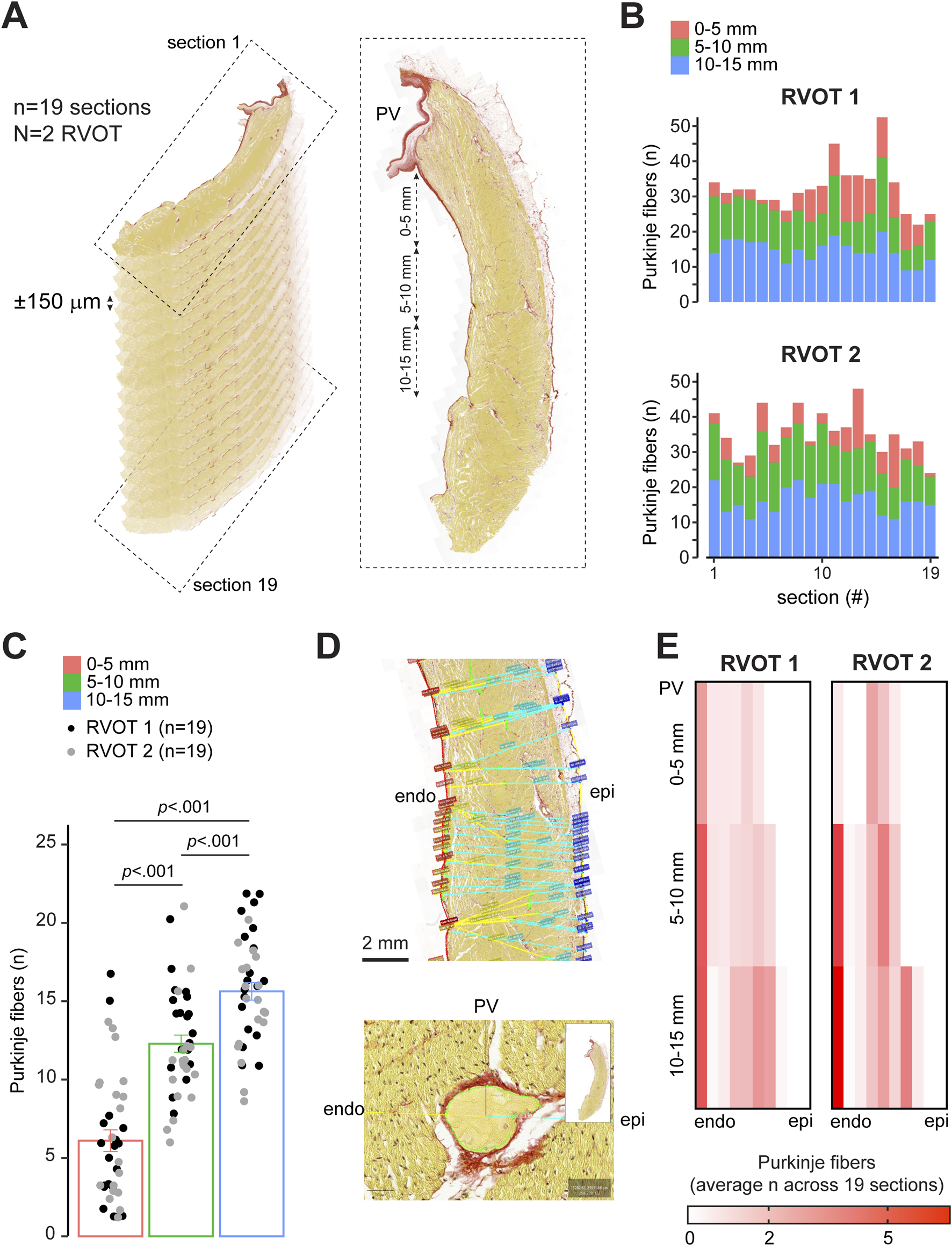 A scientific illustration with multiple panels showing data on Purkinje fibers in the right ventricular outflow tract (RVOT). Panel A displays a 3D reconstruction and cross-section of the RVOT, marked with sections. Panel B includes bar graphs comparing Purkinje fibers in two RVOT samples across sections. Panel C presents a dot plot illustrating the number of Purkinje fibers at different depths, with statistical significance indicated. Panel D shows histological images highlighting Purkinje fiber distribution from endo- to epicardial surfaces. Panel E provides heat maps depicting average Purkinje fiber counts at various depths for two samples.