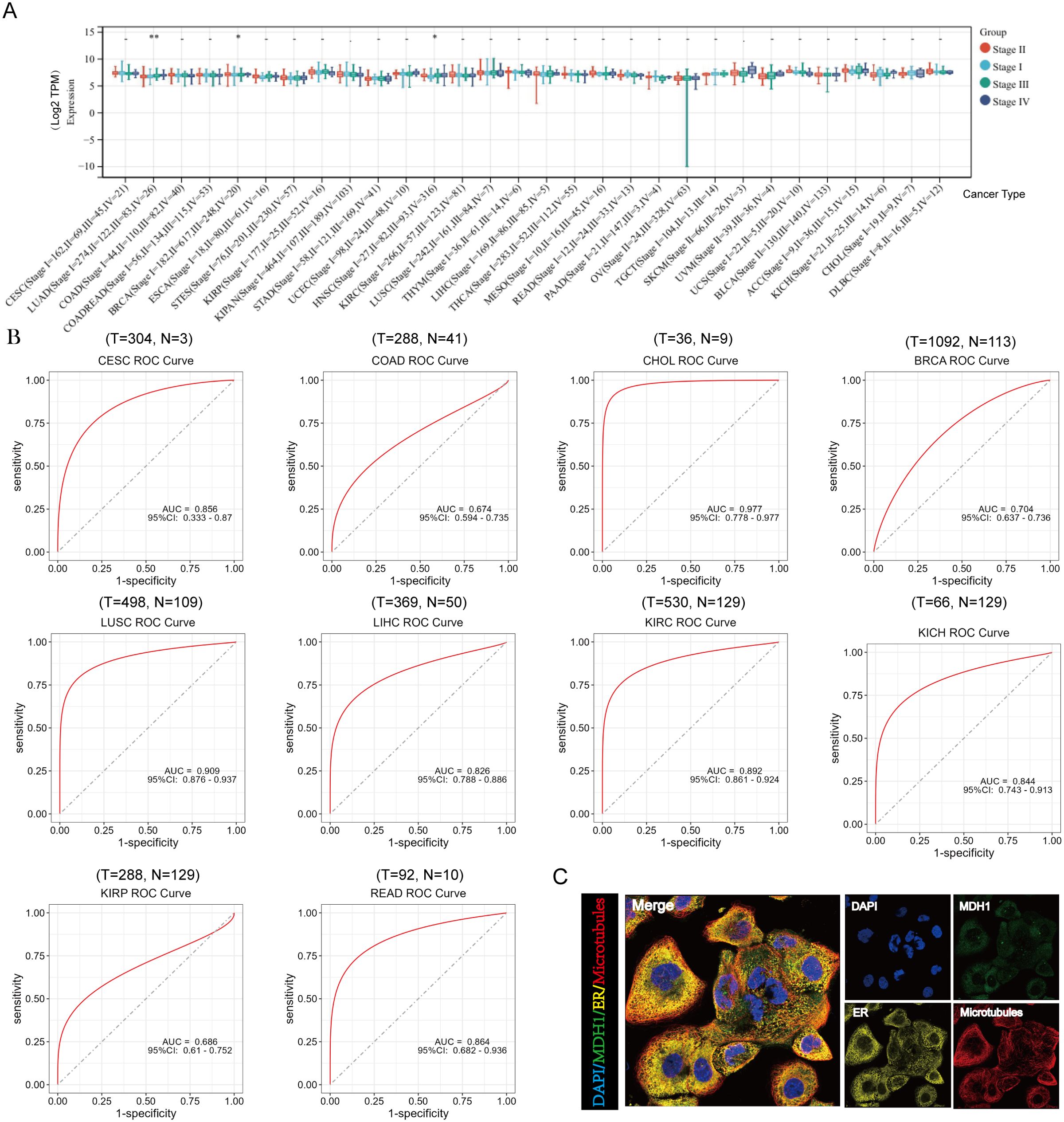 Panel A displays a box plot illustrating gene expression across various cancer types, grouped by stage. Panel B presents multiple ROC curves for different cancers, showing sensitivity versus specificity, each with an AUC value. Panel C features microscopy images of cells stained to highlight different cellular components, including DAPI for nuclei, MDH1, ER, and microtubules, with a merged image combining all stains.