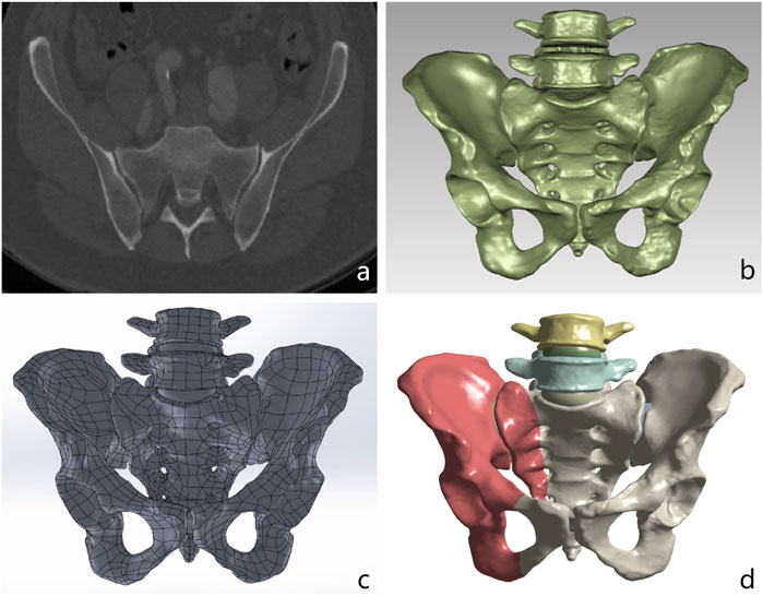 Four images show different perspectives of pelvic anatomy. Image (a) presents a CT scan with detailed bone structure. Image (b) shows a 3D rendering in green of the pelvis. Image (c) features a wireframe model highlighting structural contours. Image (d) displays a multicolored 3D model with distinct colors for various bone segments.