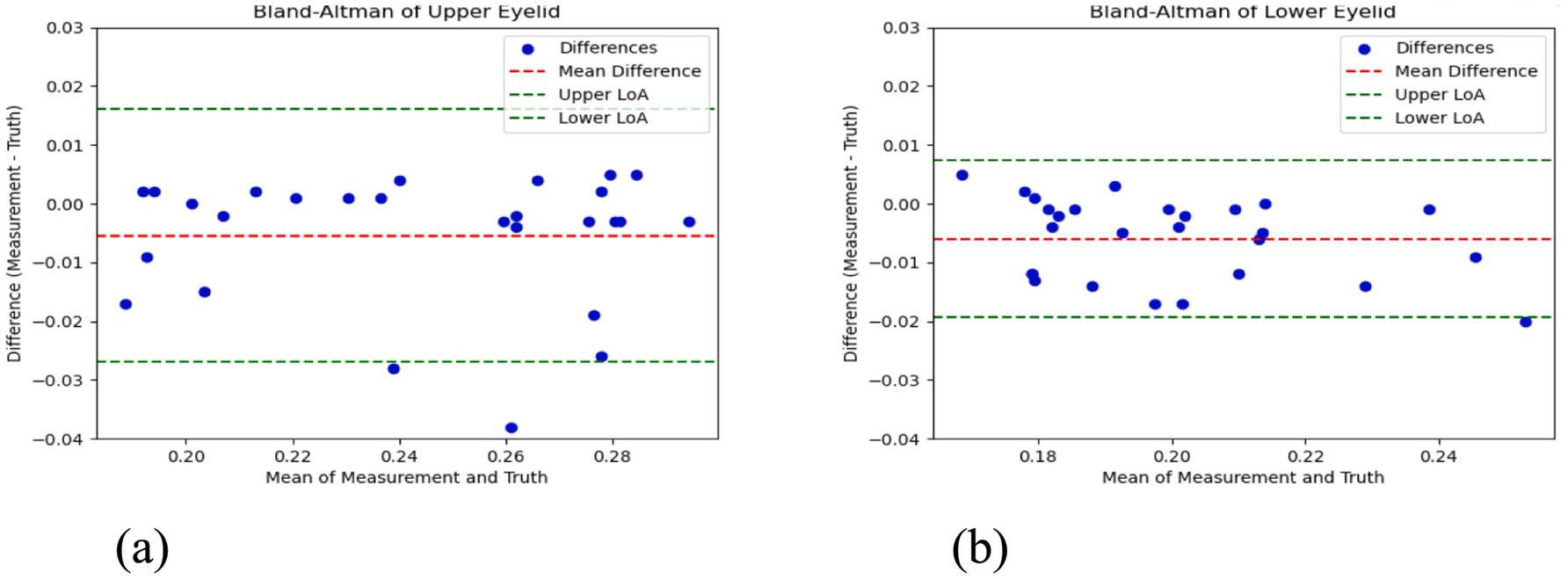 Two Bland-Altman plots comparing measurements against truth. Plot (a) shows data for the upper eyelid, and plot (b) for the lower eyelid. Both plots display differences on the vertical axis and the mean of measurements on the horizontal axis. Blue points represent data differences. Red dashed lines indicate mean differences, while green dashed lines denote upper and lower limits of agreement.