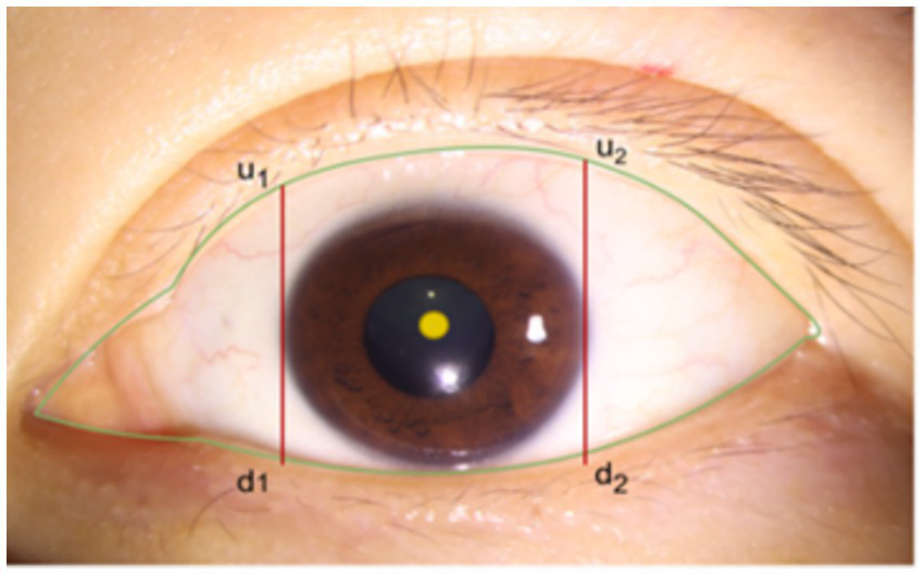 Close-up of a human eye with annotations. The image shows the brown iris and pupil with a yellow dot reflecting light. Red vertical lines labeled "u1," "d1," "u2," and "d2" mark specific points on the upper and lower eyelids. A green line outlines the shape of the eyelid.