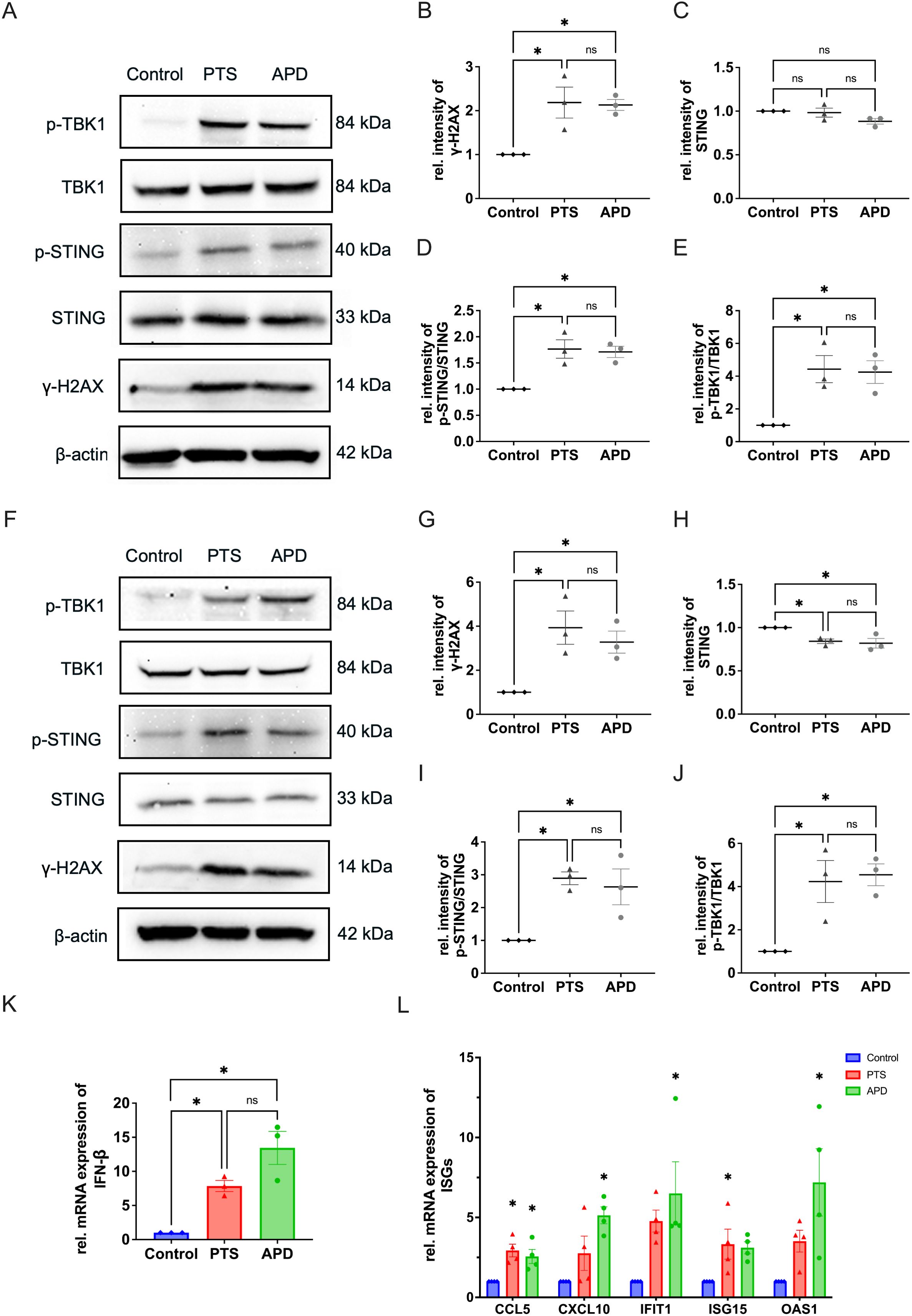 Western blot and bar graph analysis showing protein and mRNA expression levels in control, PTS, and APD groups. Panels A and F display bands for proteins such as p-TBK1, TBK1, p-STING, STING, γ-H2AX, and β-actin. Panels B to E and G to J show relative intensity comparisons between these proteins across groups, indicating statistical significance (* and ns symbols). Panels K and L present bar graphs for mRNA expression levels of IFN and ISGs genes (CCL5, CXCL10, IFIT1, ISG15, OAS1). Statistical comparisons are marked with * for significant and ns for non-significant.