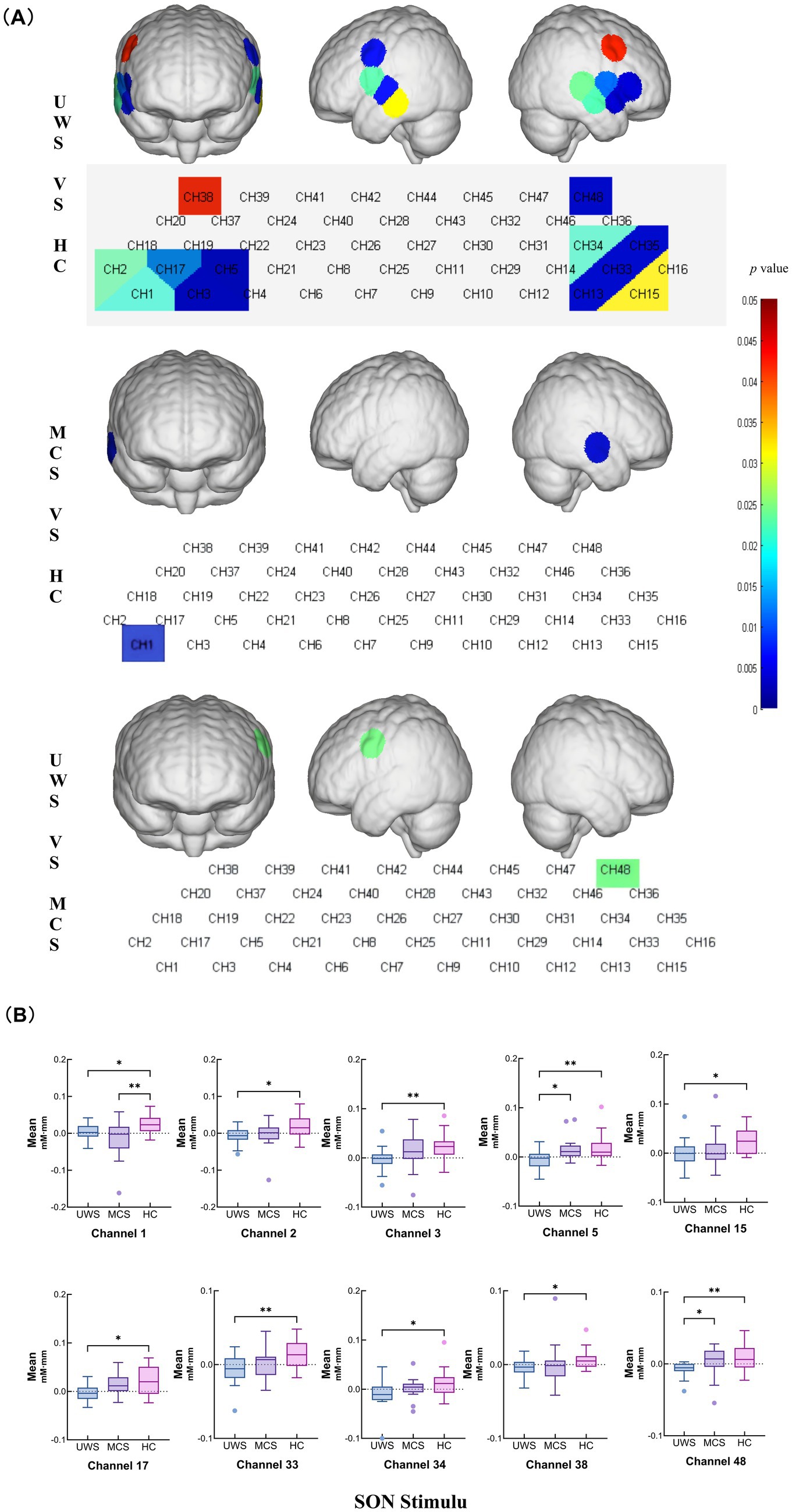 Three panels of brain images and box plots depict brain regions and statistical data comparisons. Panel A shows mapped brain areas for UWS vs. HC, MCS vs. HC, and UWS vs. MCS, using colored regions indicating significance based on the p-value scale. Panel B displays box plots for channels one, two, three, five, fifteen, seventeen, thirty-three, thirty-four, thirty-eight, and forty-eight comparing UWS, MCS, and HC groups under SON stimulus, highlighting differences through asterisk markers indicating statistical significance.
