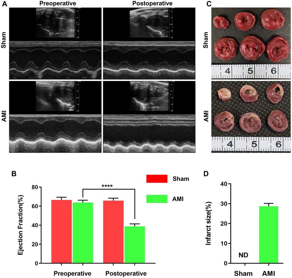 Panel A shows ultrasound images of heart function preoperative and postoperative for Sham and AMI groups. Panel B is a bar graph of ejection fraction percentages, showing a significant decrease in the AMI group postoperatively. Panel C displays cross-sectional images of hearts from Sham and AMI groups, with visible differences in tissue appearance. Panel D is a bar graph showing infarct size as a percentage, with the AMI group presenting a significant infarct size compared to Sham.