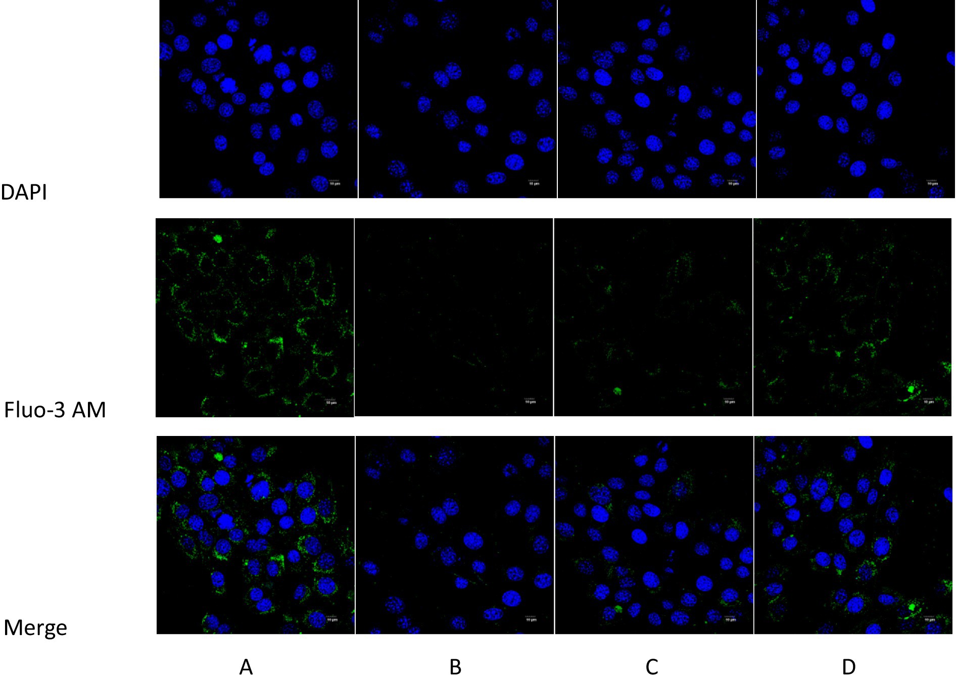 Fluorescence microscopy images in four columns labeled A to D. The top row shows DAPI-stained nuclei in blue, the middle row shows Fluo-3 AM staining in green indicating calcium presence, and the bottom row merges these channels. Each column shows different conditions with varying fluorescence intensities.
