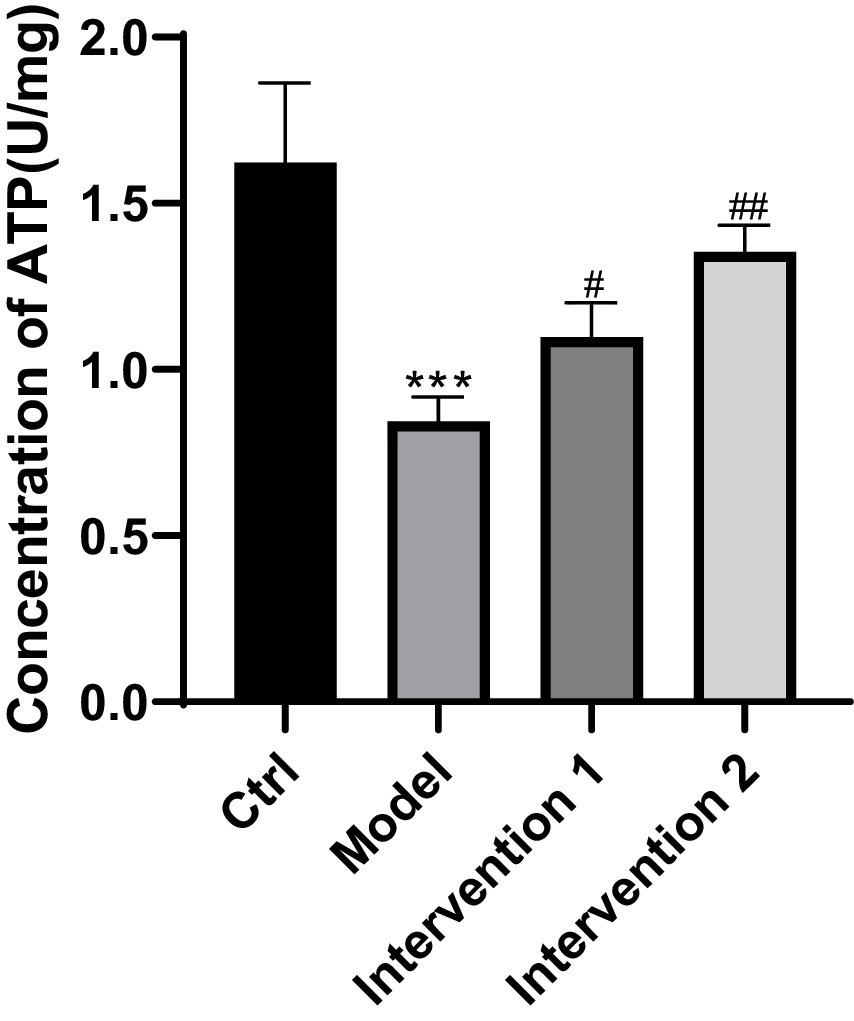 Bar chart displaying ATP concentration in U/mg for four groups: Control (approximately 1.55), Model (approximately 0.8, marked with three asterisks), Intervention 1 (approximately 1.1, marked with one hash), and Intervention 2 (approximately 1.3, marked with two hashes).