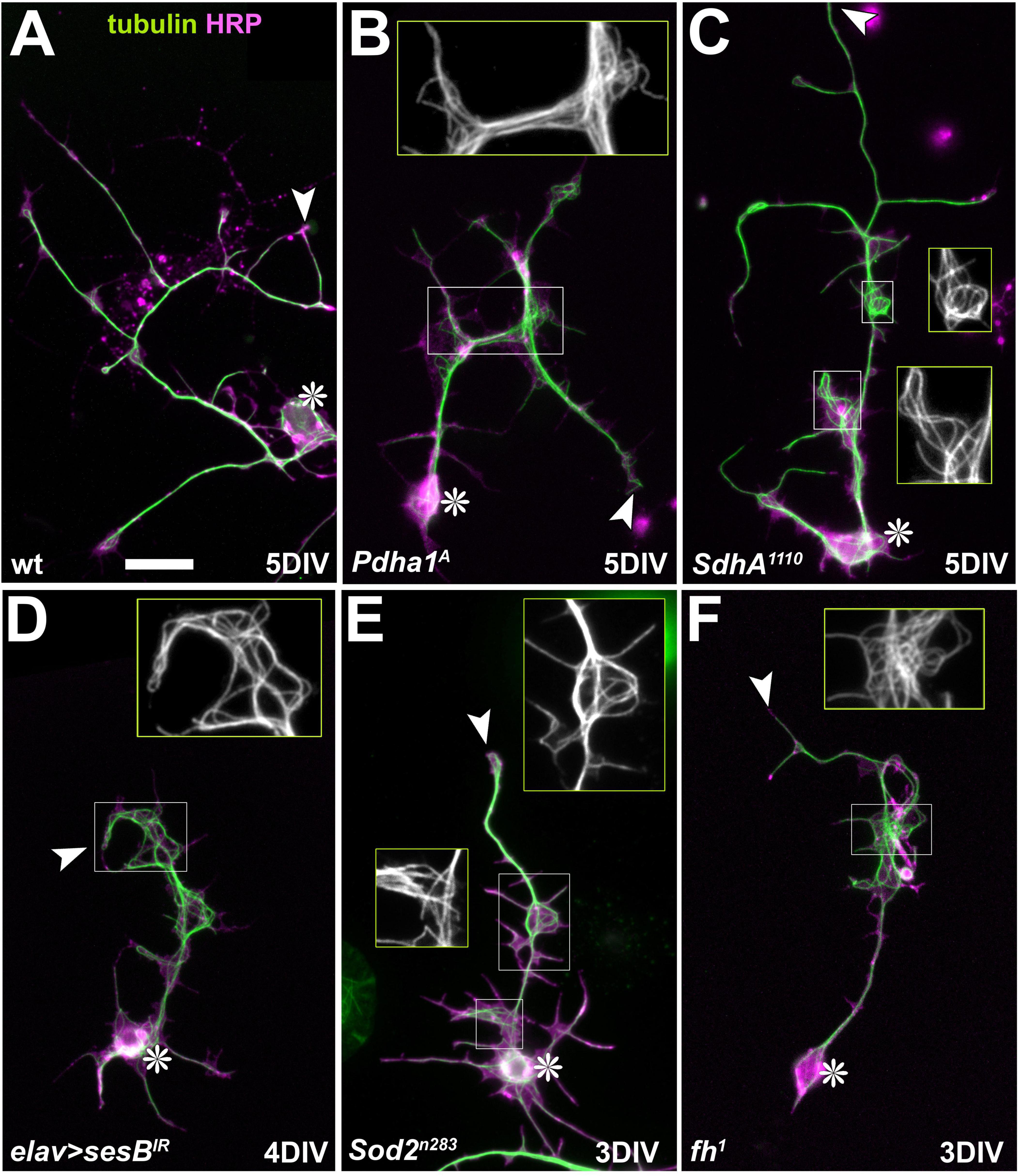 Fluorescent microscopy images showcasing neuron structures using tubulin (green) and HRP (magenta) staining. Panels A to F display different genetic variations and development stages (3DIV to 5DIV). Insets in each panel highlight detailed views of neuronal connections. White arrows and asterisks mark specific structural features.