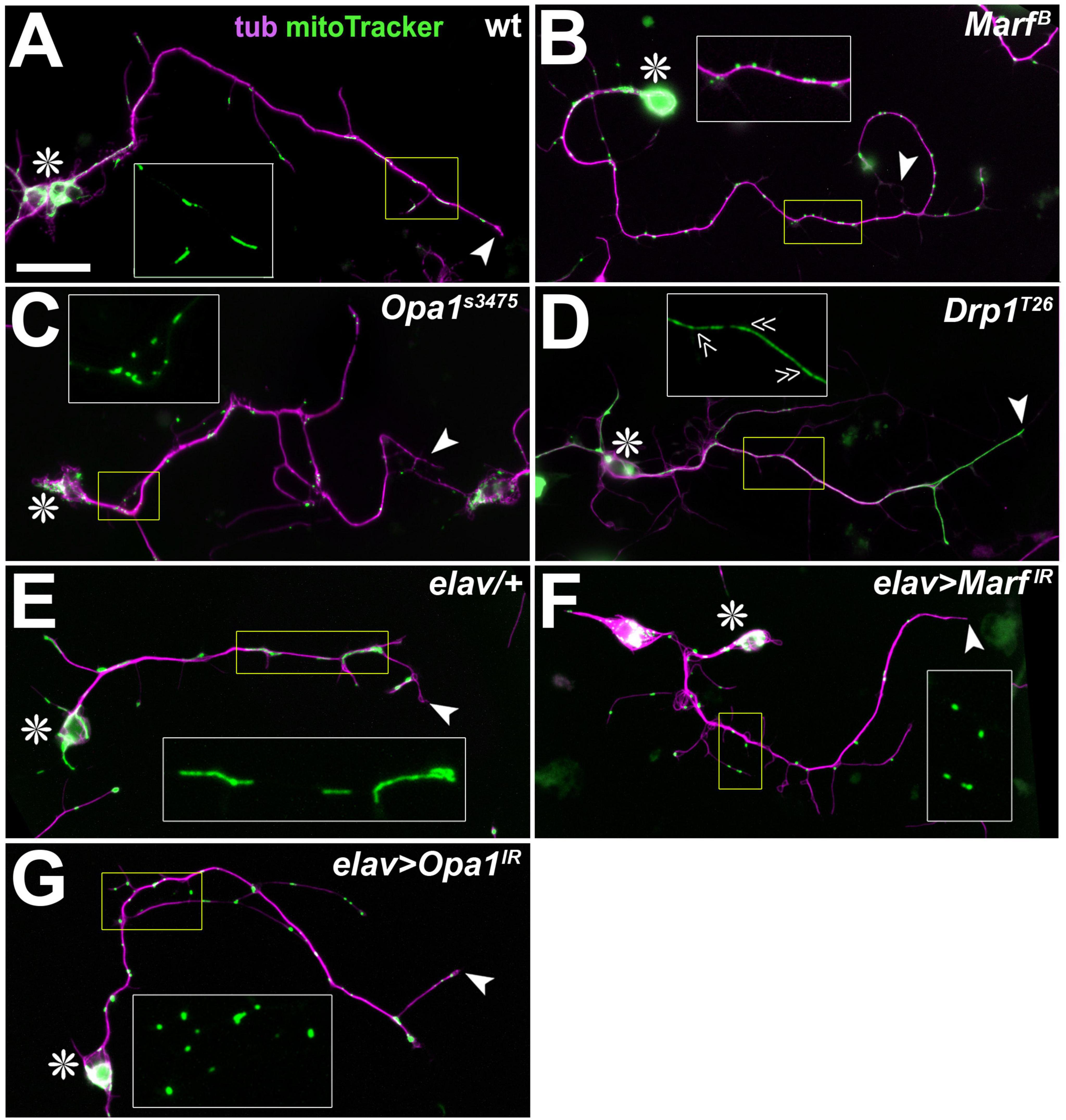 Fluorescent micrographs showing various genetic mutations. Each panel (A to G) displays nerve cells labeled with tubulin (purple) and mitochondria (green). Insets highlight specific mitochondrial structures. Each image includes an asterisk marking cell bodies and arrowheads indicating neurite tips.