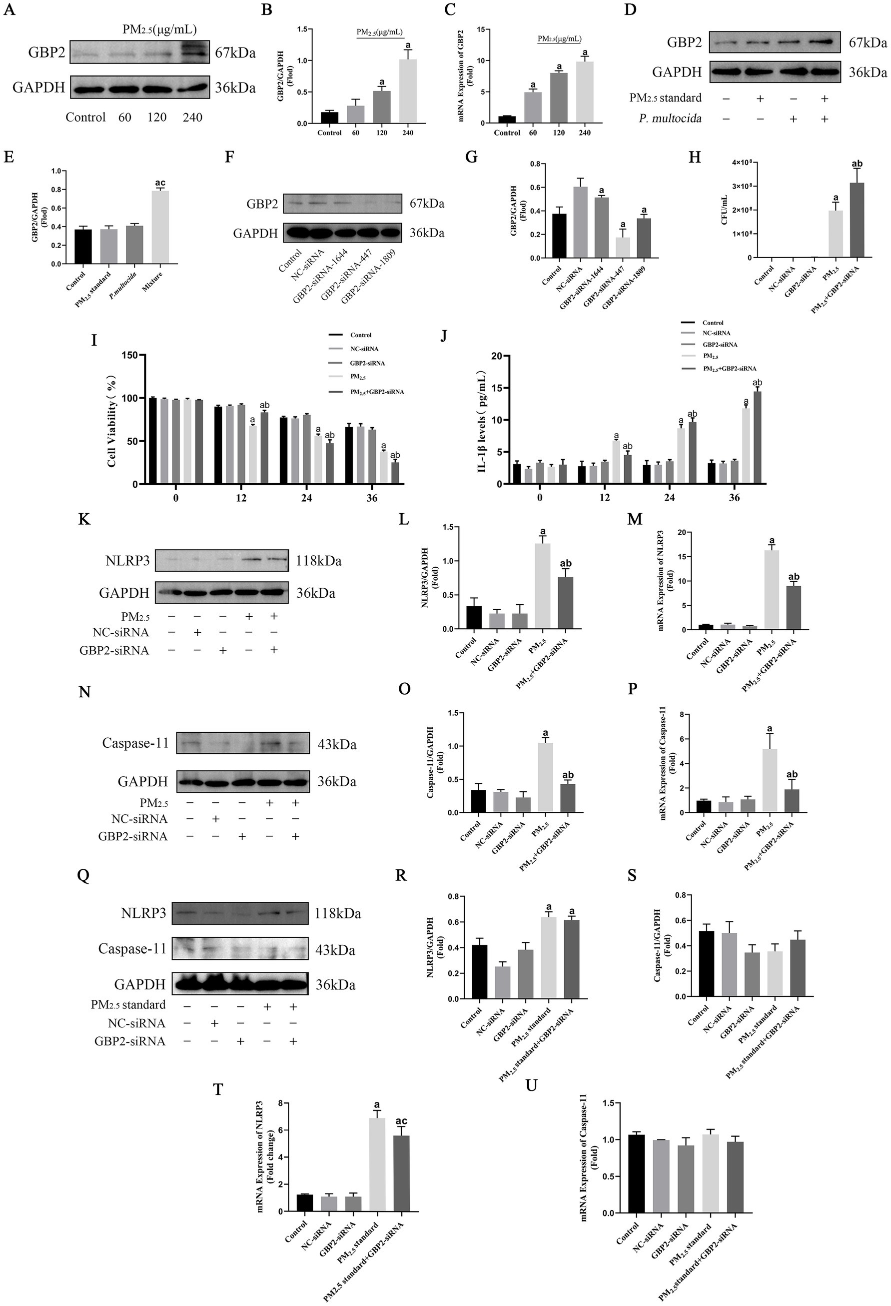 Various panels display protein expression and gene activity in response to different treatments. Panels A, D, F, K, N, and Q show Western blot results for proteins like GBP2, NLRP3, and Caspase-11, indicating expression levels under specific conditions. Panels B, C, E, G, H, I, J, L, M, O, P, R, S, T, and U are graphs depicting quantitative results of protein and gene expression, cell viability, and cytokine levels in different experimental settings, illustrating the impact of treatments such as siRNA and exposure to particulate matter.