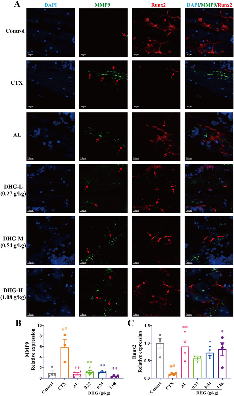 Fluorescent microscopy images and graphs depicting MMP9 and Runx2 expression. Panel A shows images of cells under various conditions: Control, CTX, AL, and different doses of DHG, with DAPI in blue, MMP9 in green, and Runx2 in red. Panels B and C present bar graphs of MMP9 and Runx2 relative expression across the same conditions, with varying levels indicated by symbols. Scale bars are provided for microscopy images.